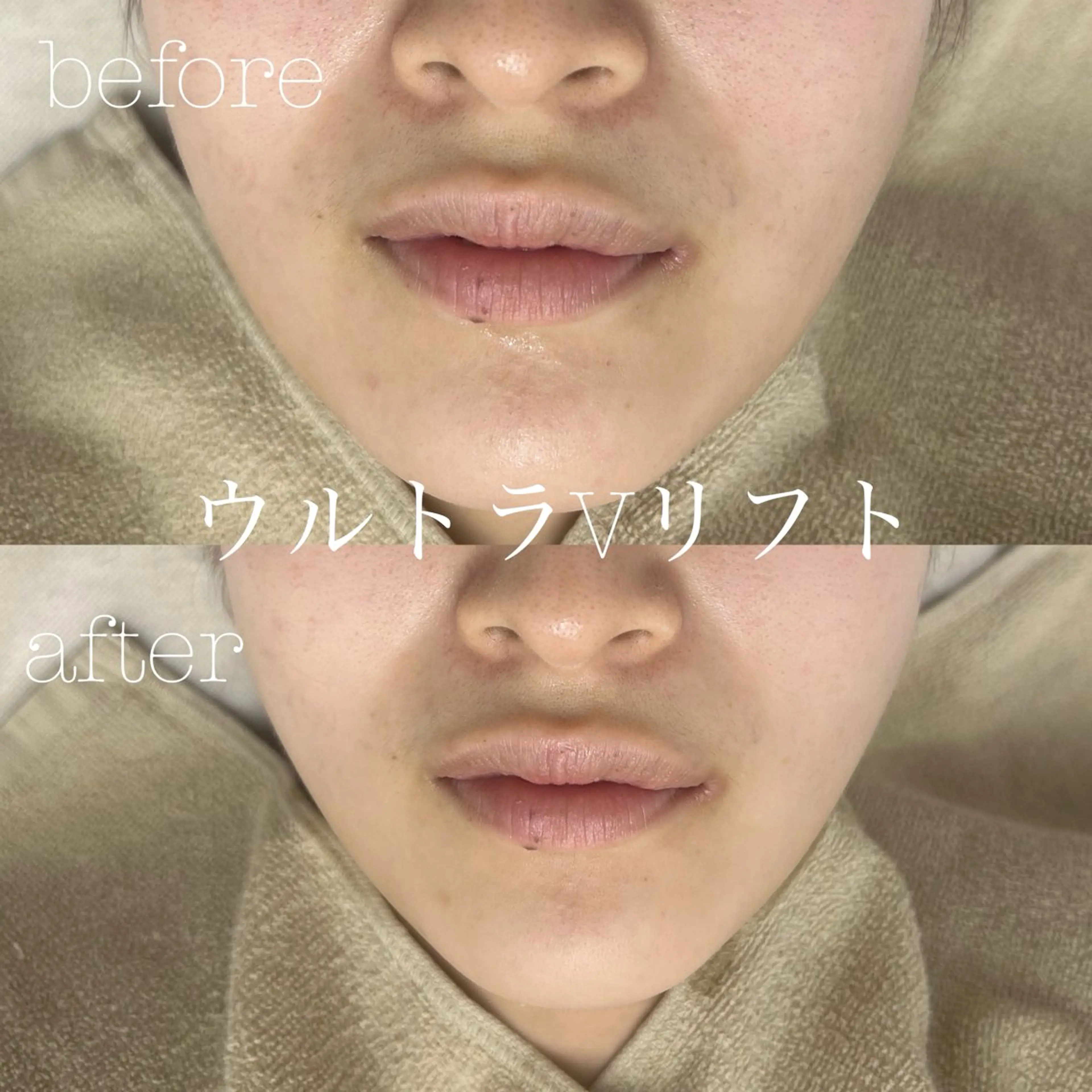 エステ フェイシャルサロン CHIARA 荒田のエステ・リラクイメージ