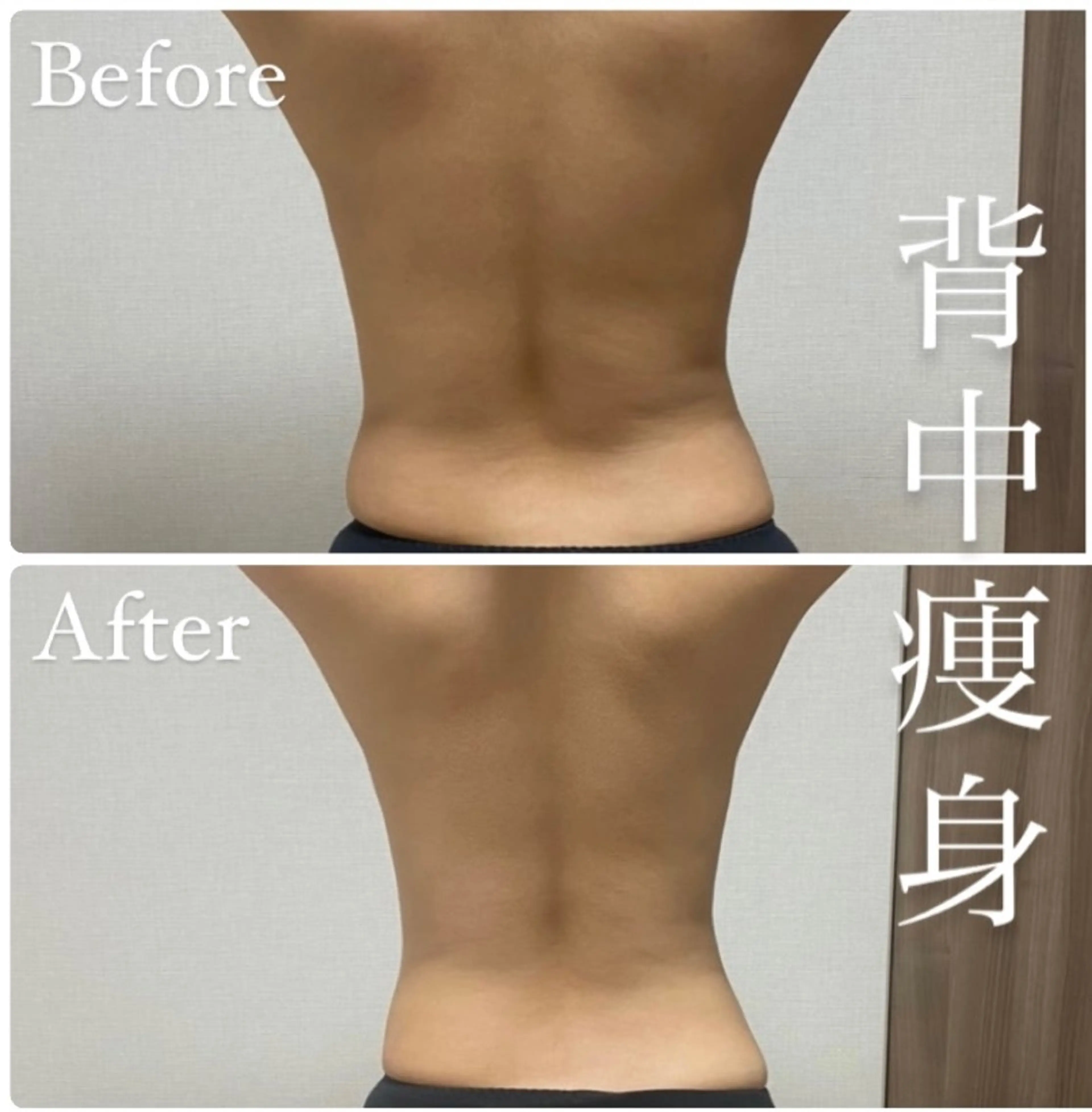 beautysalon RAVIS所属・東大阪/韓国肌管理/ 痩身バスト専門店のエステ・リラクイメージ