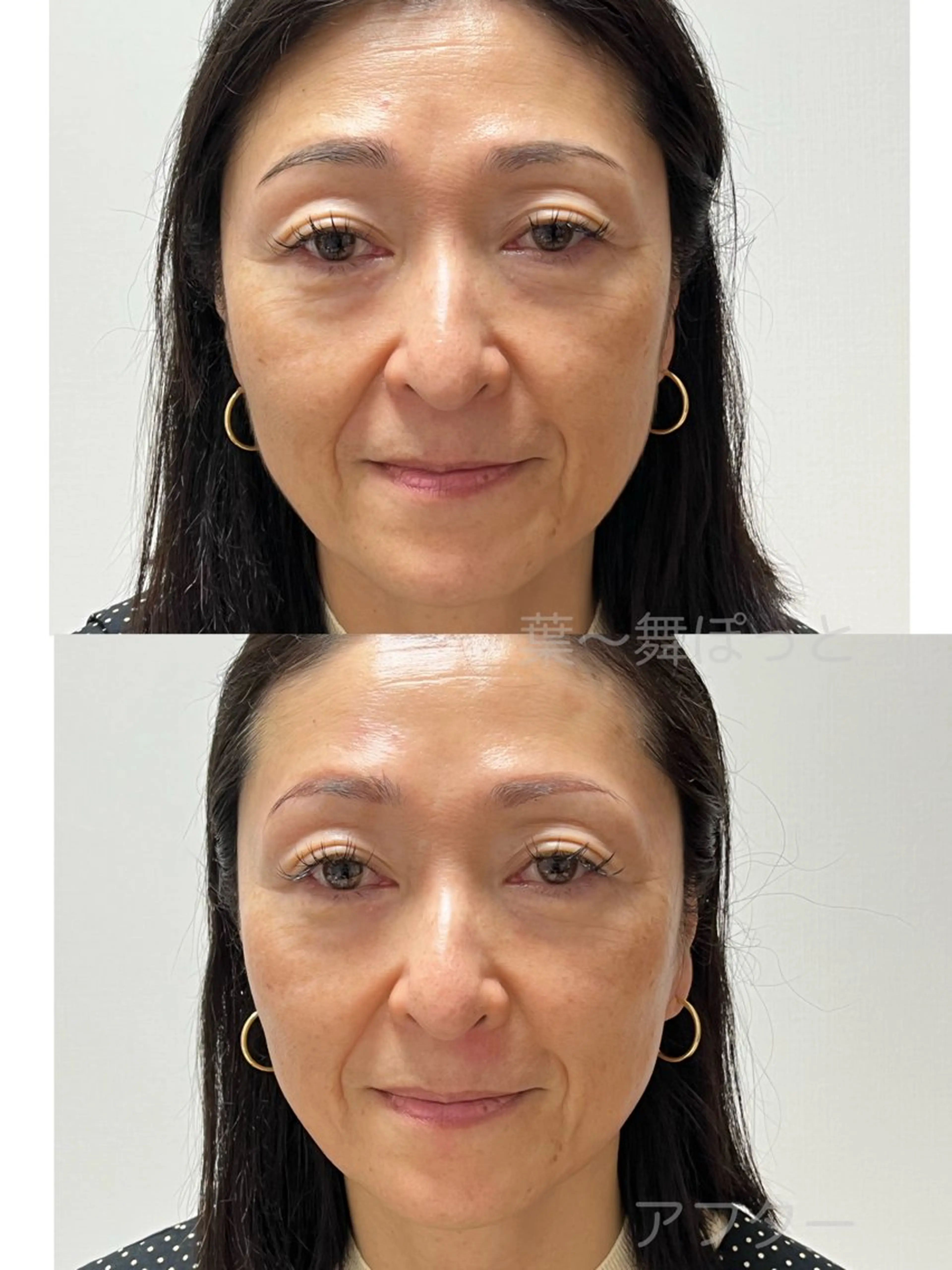 うえつま ふみえのエステ・リラクイメージ