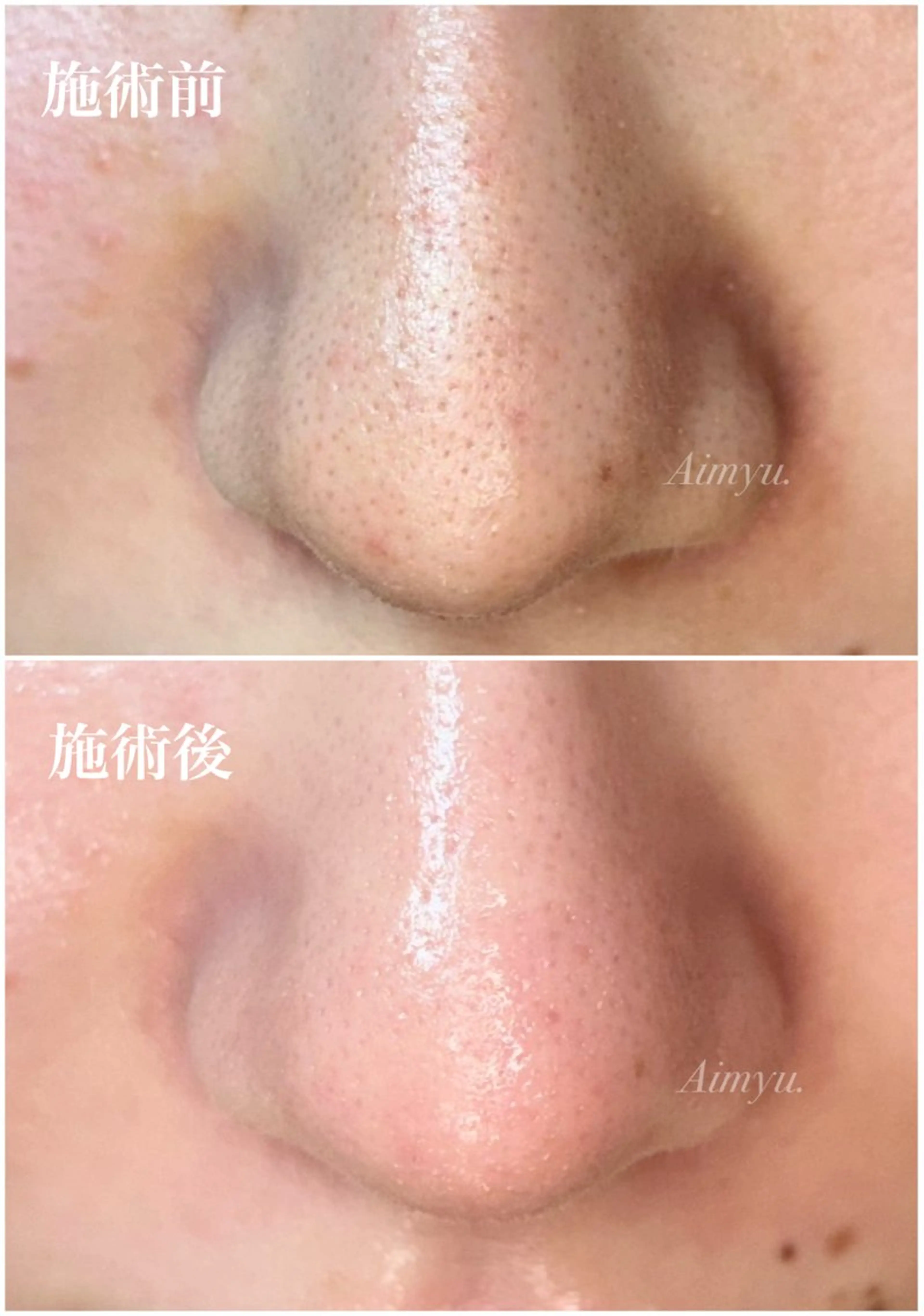 毛穴専門店アイミュー mamiのエステ・リラクイメージ