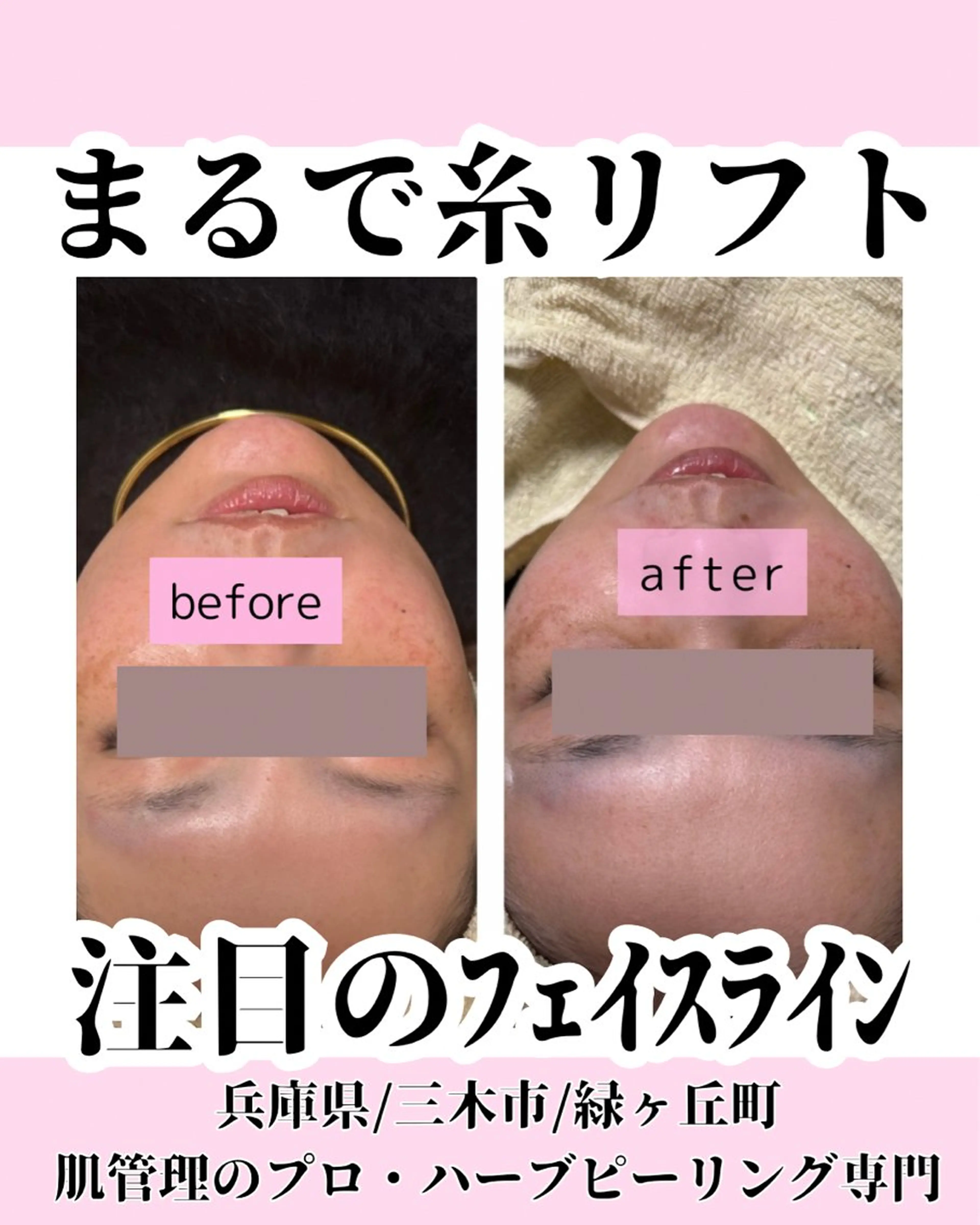 エステ ハーブピーリング 専門／今榮麻美のエステ・リラクイメージ