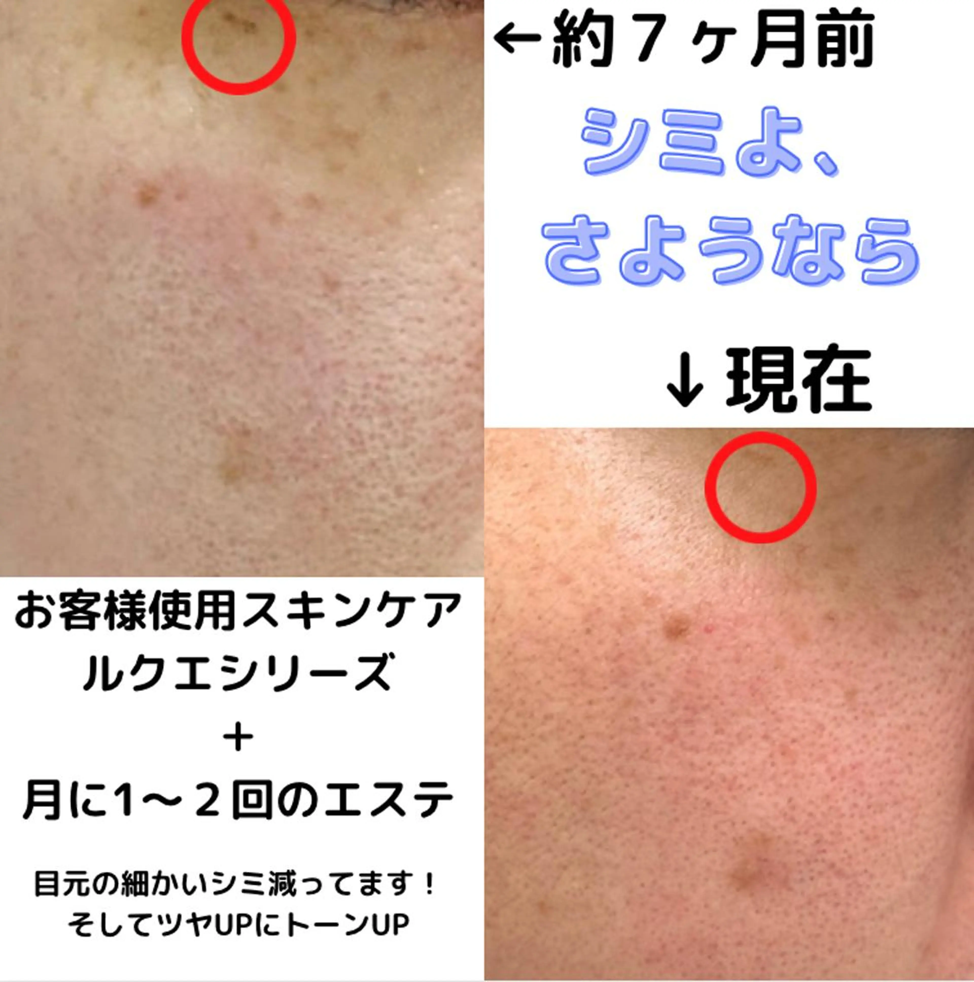 ミューズエステ 谷口美結のエステ・リラクイメージ