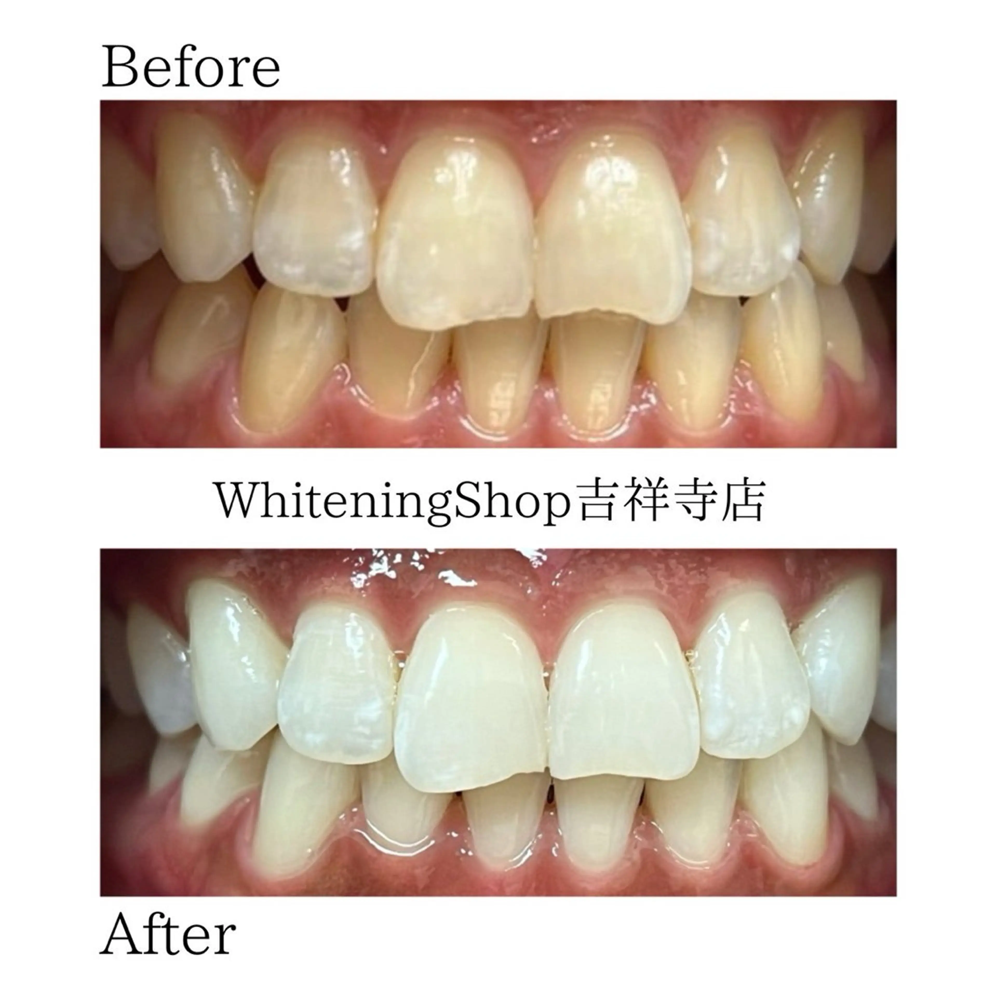 エステ リラク ホワイトニング ショップ吉祥寺店のエステ・リラクイメージ