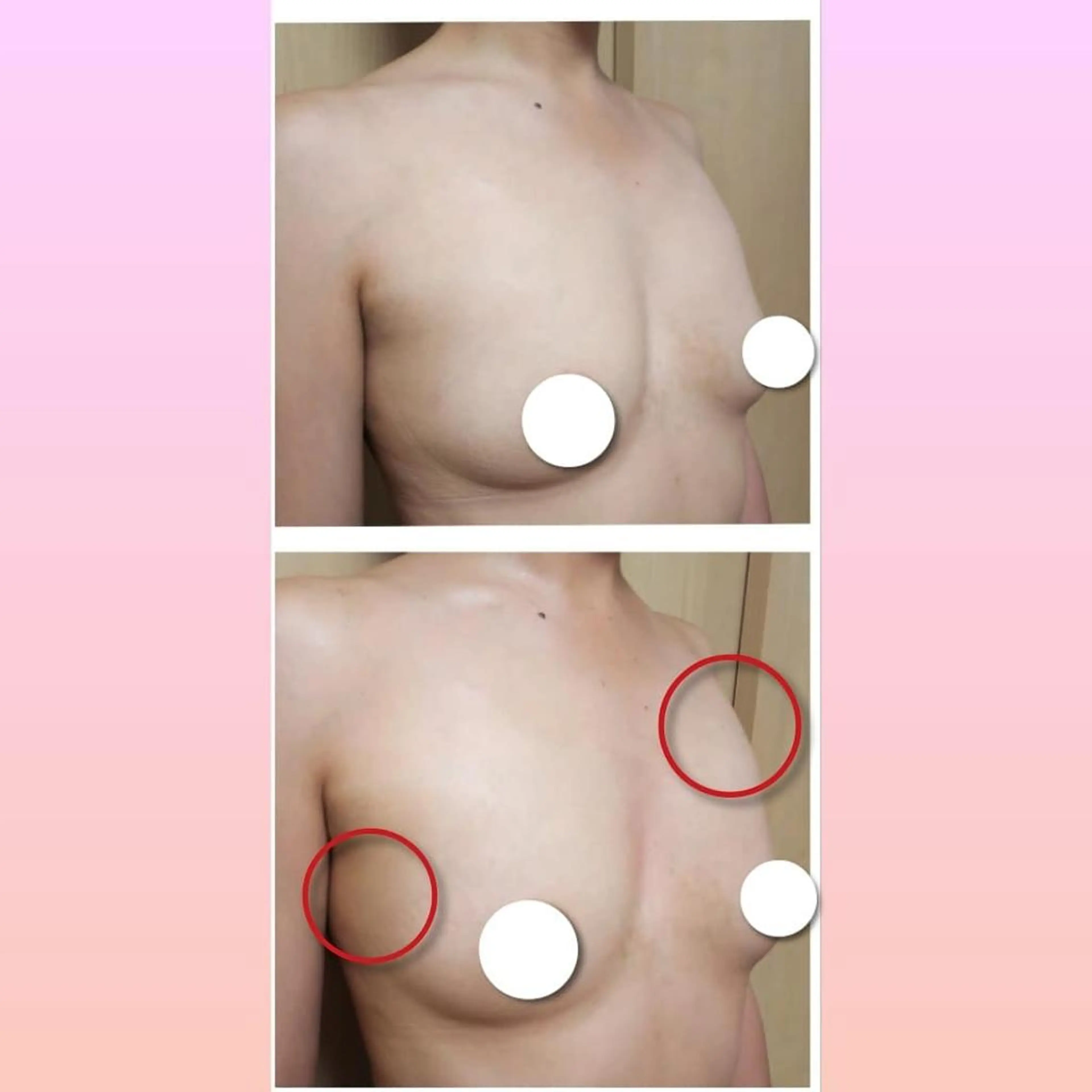 バスト·毛穴サロン Mixtureのエステ・リラクイメージ