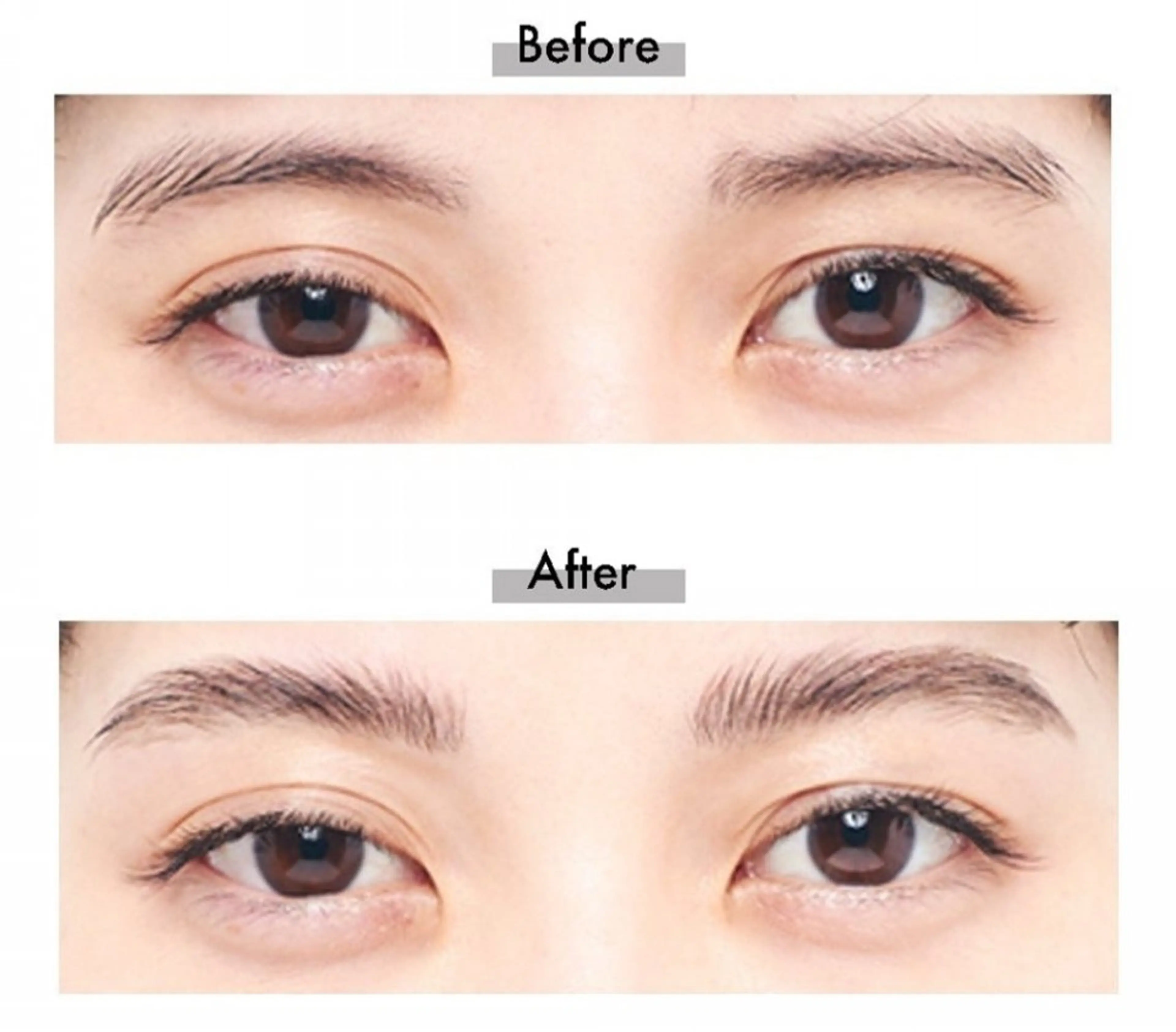 美眉矯正＋眉毛wax脱毛の写真