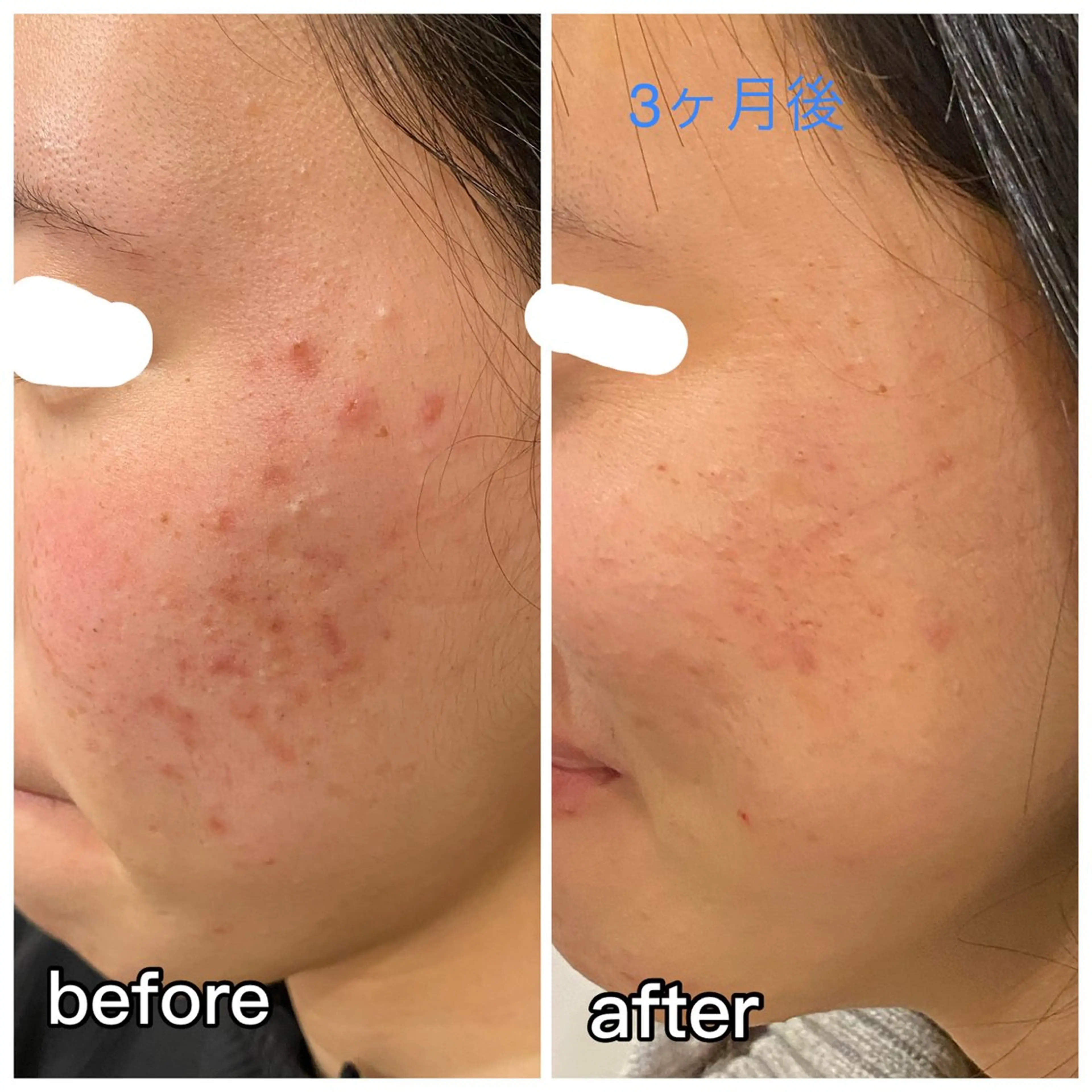 aimer beautyのエステ・リラクイメージ