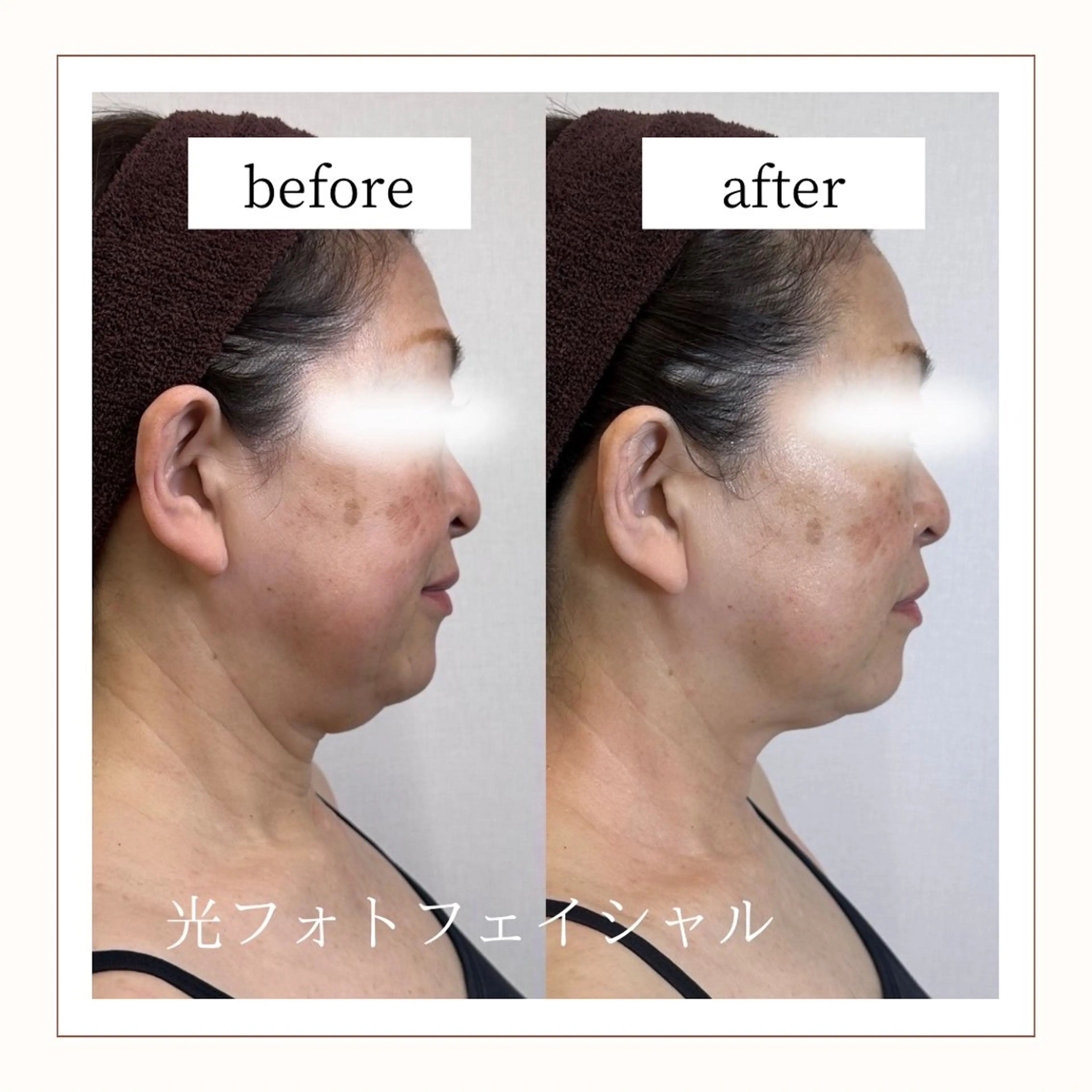 その他 Reid -月詠-のエステ・リラクイメージ