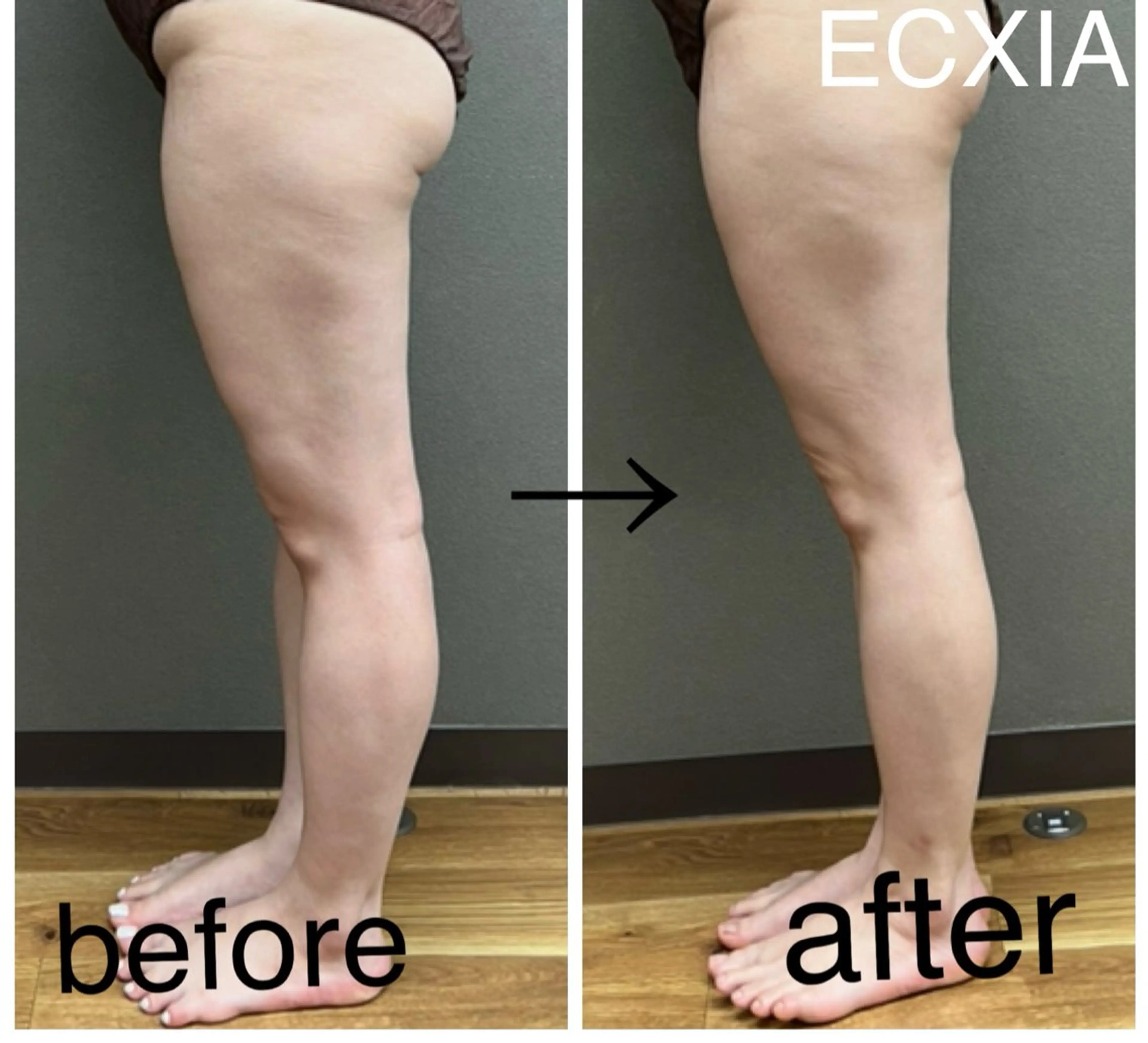 エステ リラク ECXIA 【エクシア】のエステ・リラクイメージ