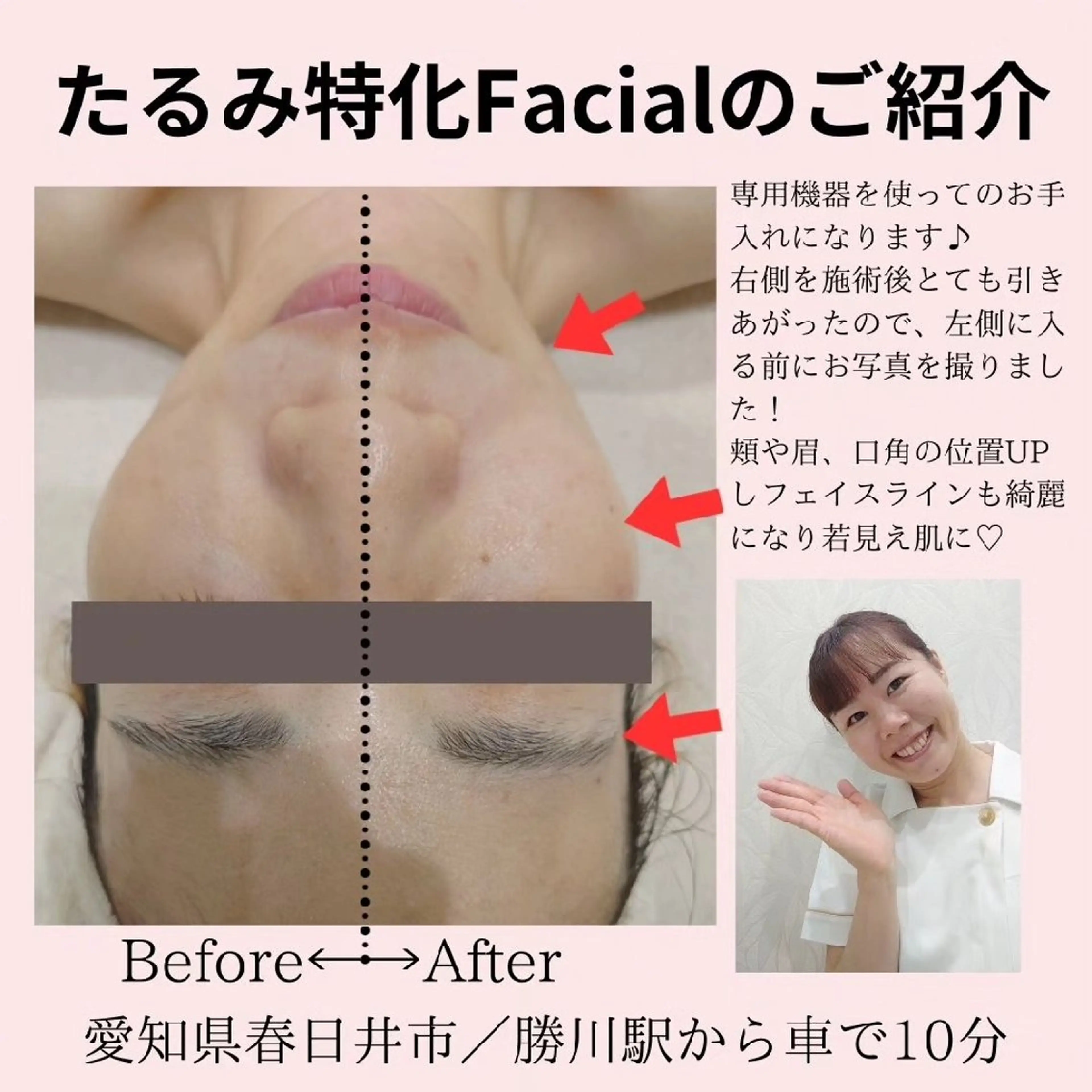 エステ PRETTIEST SHINE所属・フェイシャル/ボディ /ブライダル山田浩子のエステ・リラクイメージ