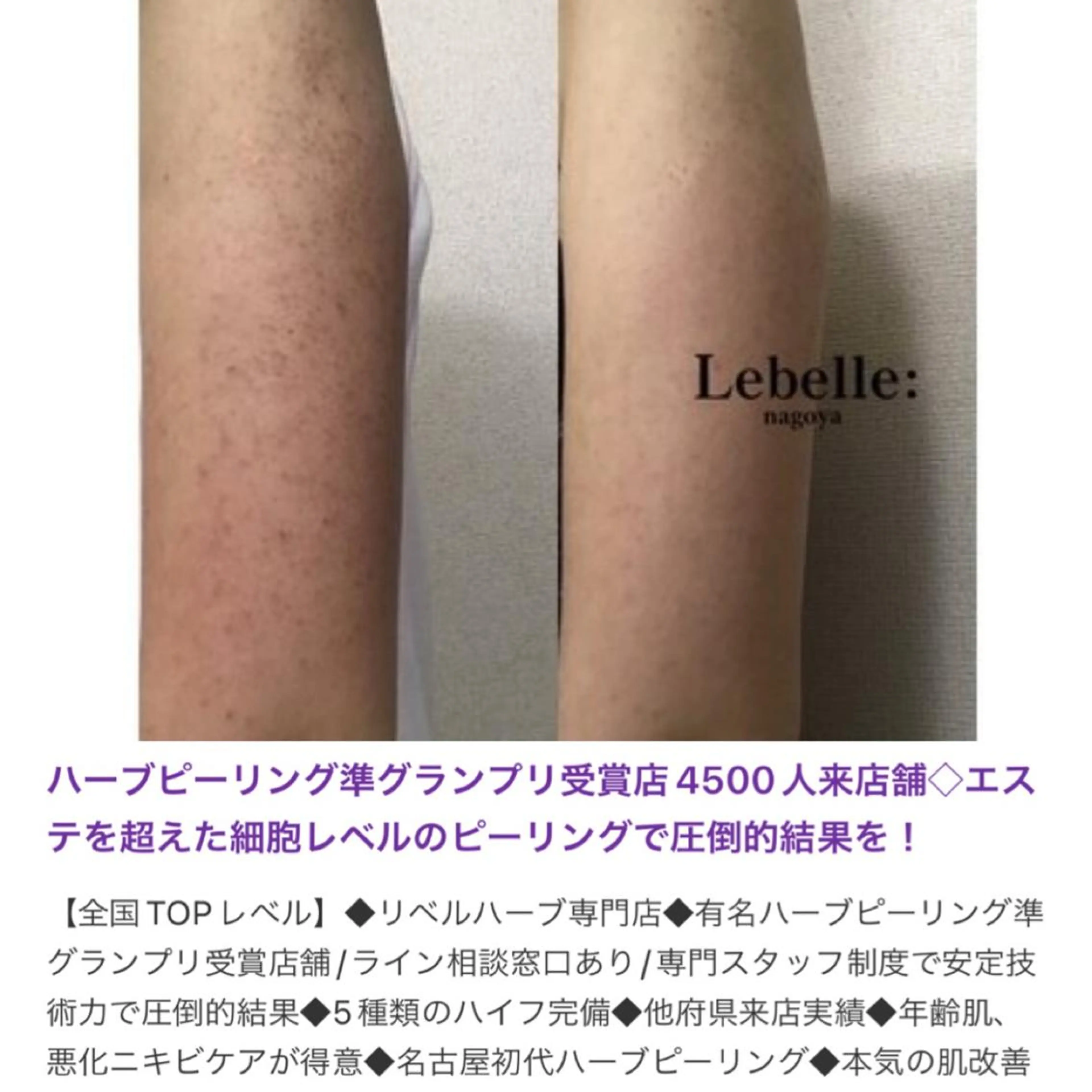 マツエク・マツパ 次世代まつげパーマは 『リベル名古屋』のマツエク・マツパデザイン