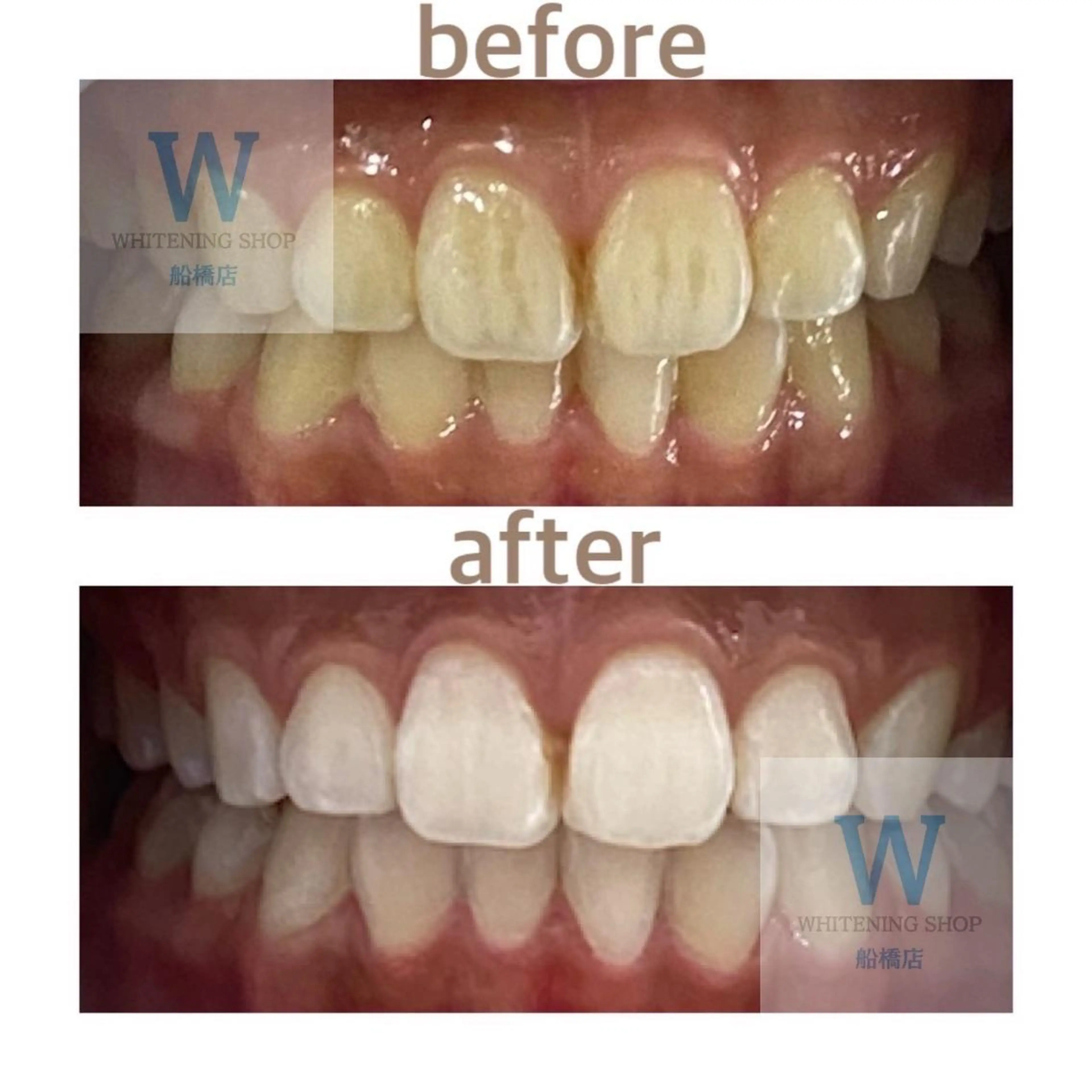 エステ リラク ホワイトニング ショップ船橋２号店のエステ・リラクイメージ