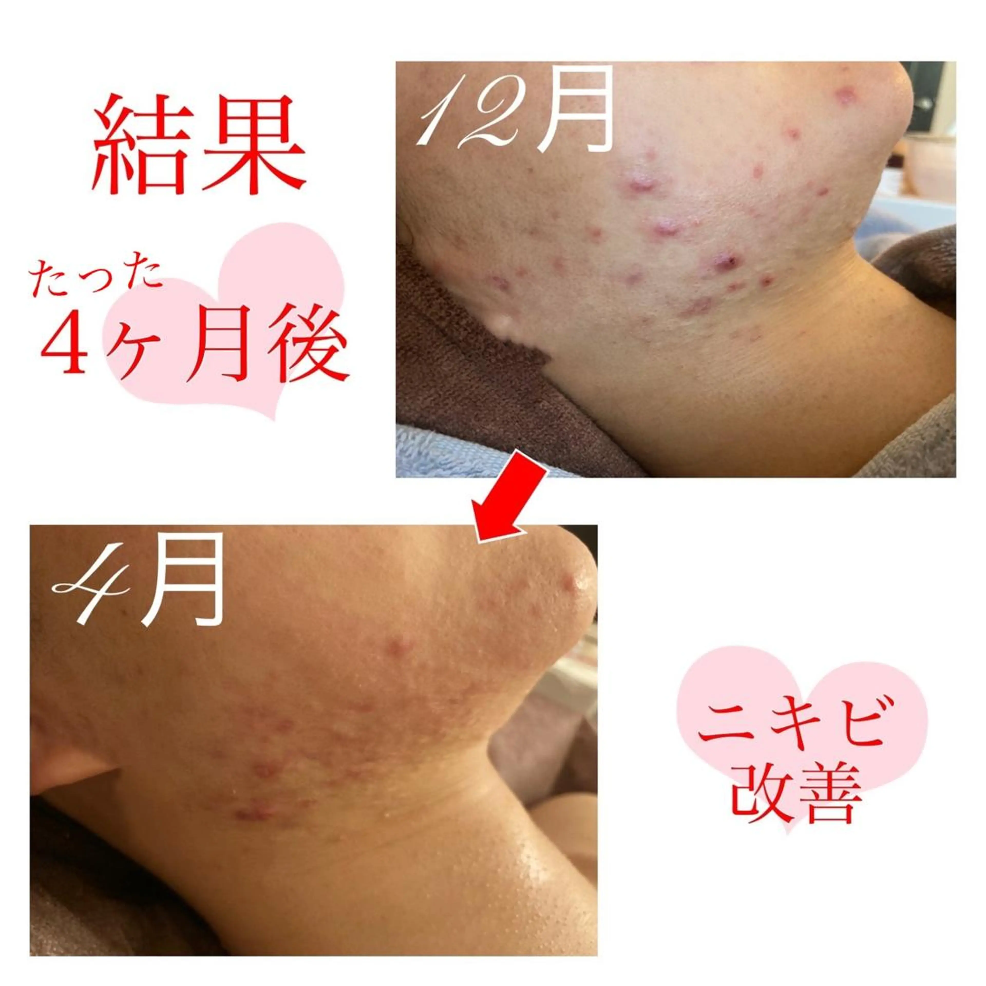 ショート カラー パーマ ヘアアレンジ メンズ キッズ ネイル マツエク・マツパ 金の糸脱毛 産毛ケア専門のエステ・リラクイメージ