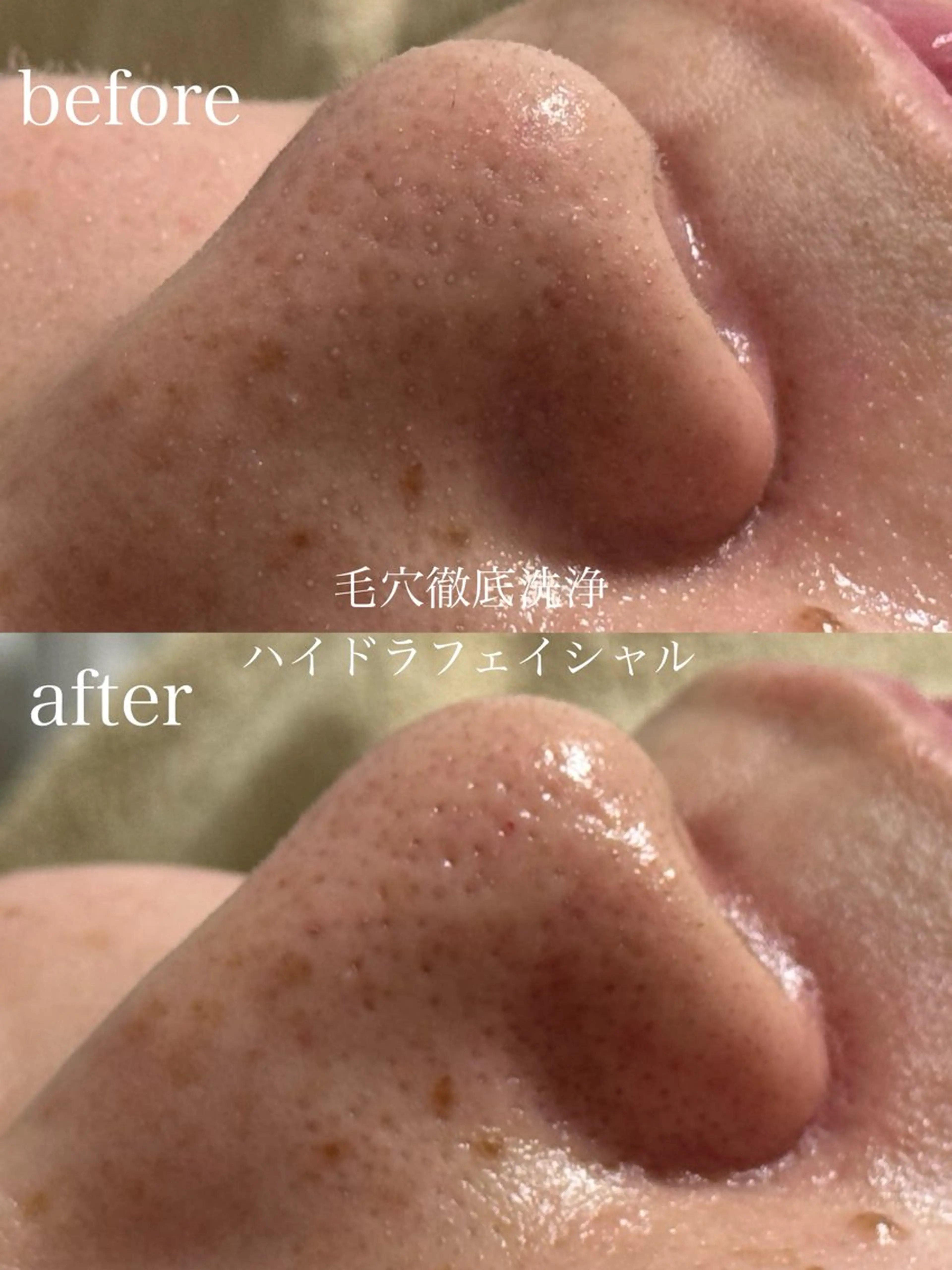 エステ フェイシャルサロン CHIARA鈴木のエステ・リラクイメージ