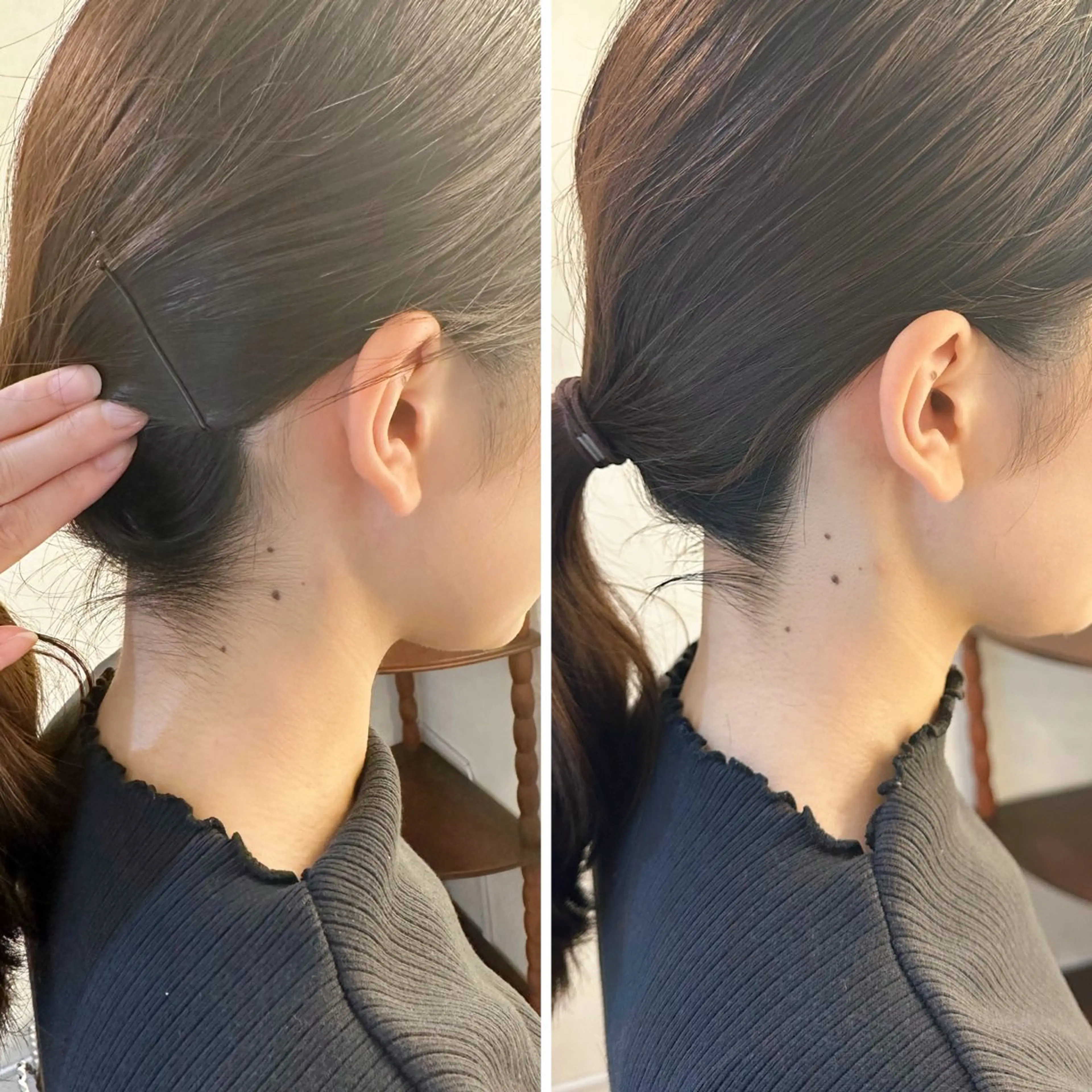 脱毛 うなじ脱毛/美肌脱毛 LABELのエステ・リラクイメージ