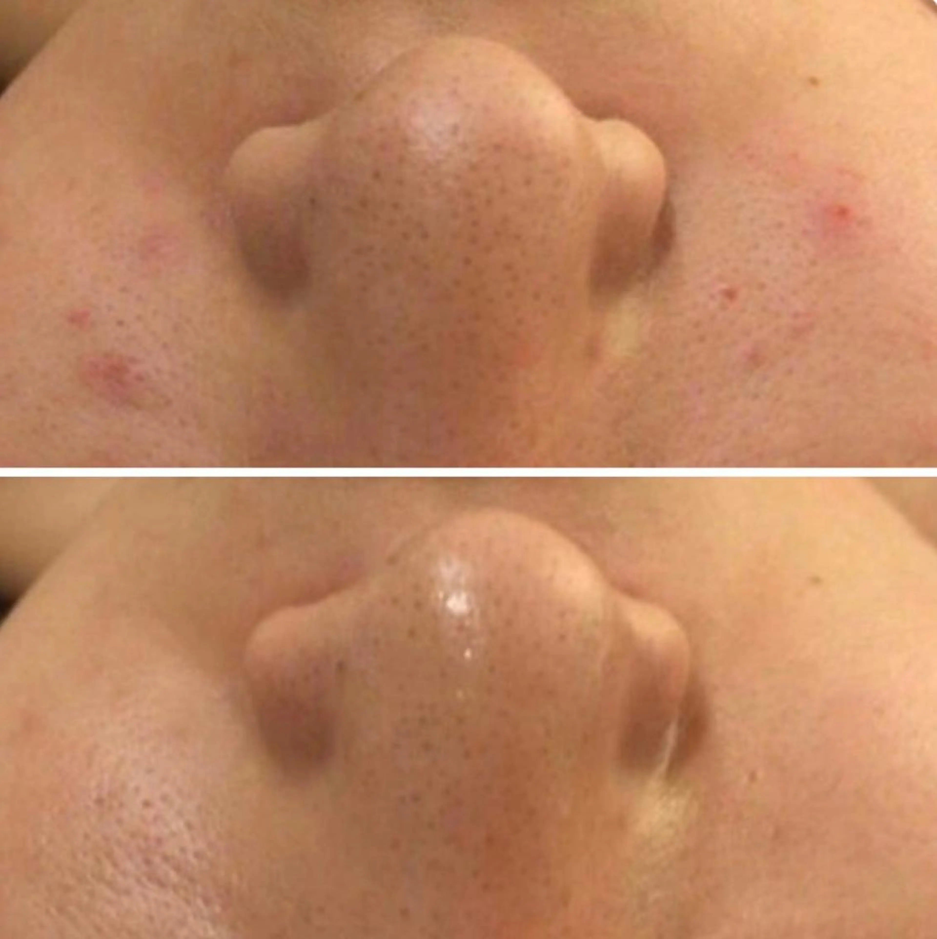 セミロング カラー パーマ ヘアアレンジ メンズ キッズ ネイル マツエク・マツパ アイブロウ 3か月で肌革命👼 ニキビ専門店💫のエステ・リラクイメージ