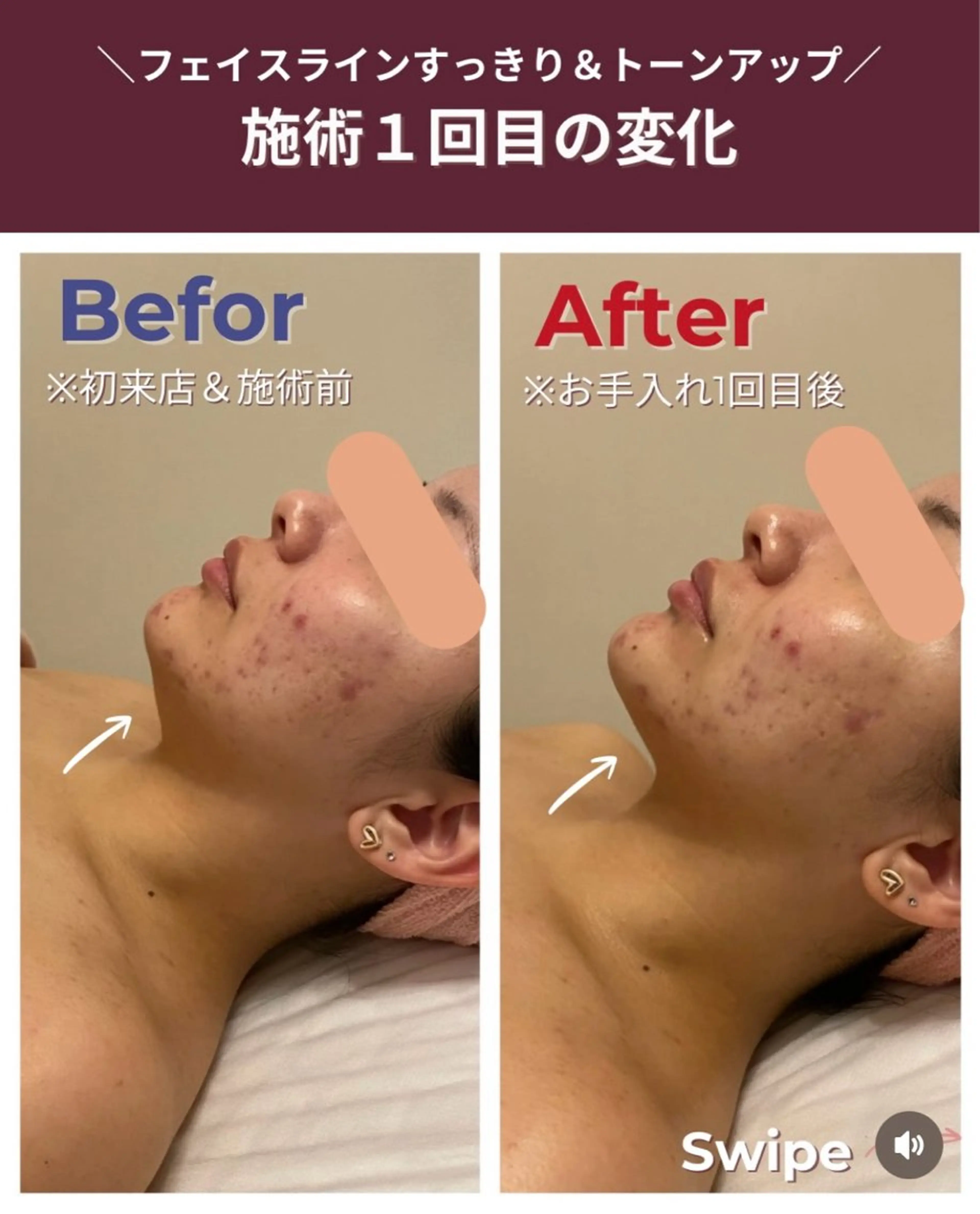 【初回限定】肩まわりガチガチ！すっきり首肩・小顔ケア体験！の写真