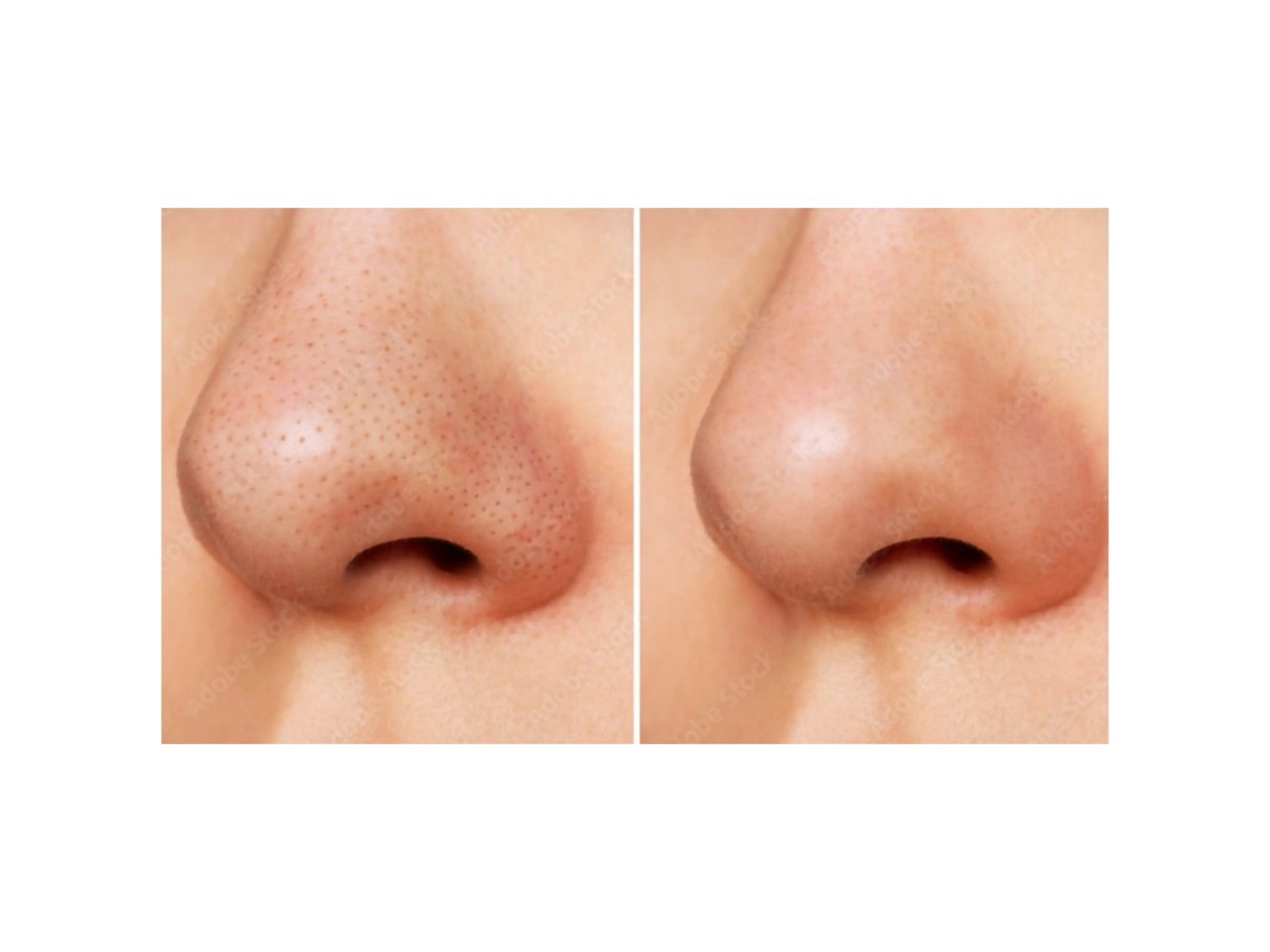 ホワイト ターコイズのエステ・リラクイメージ