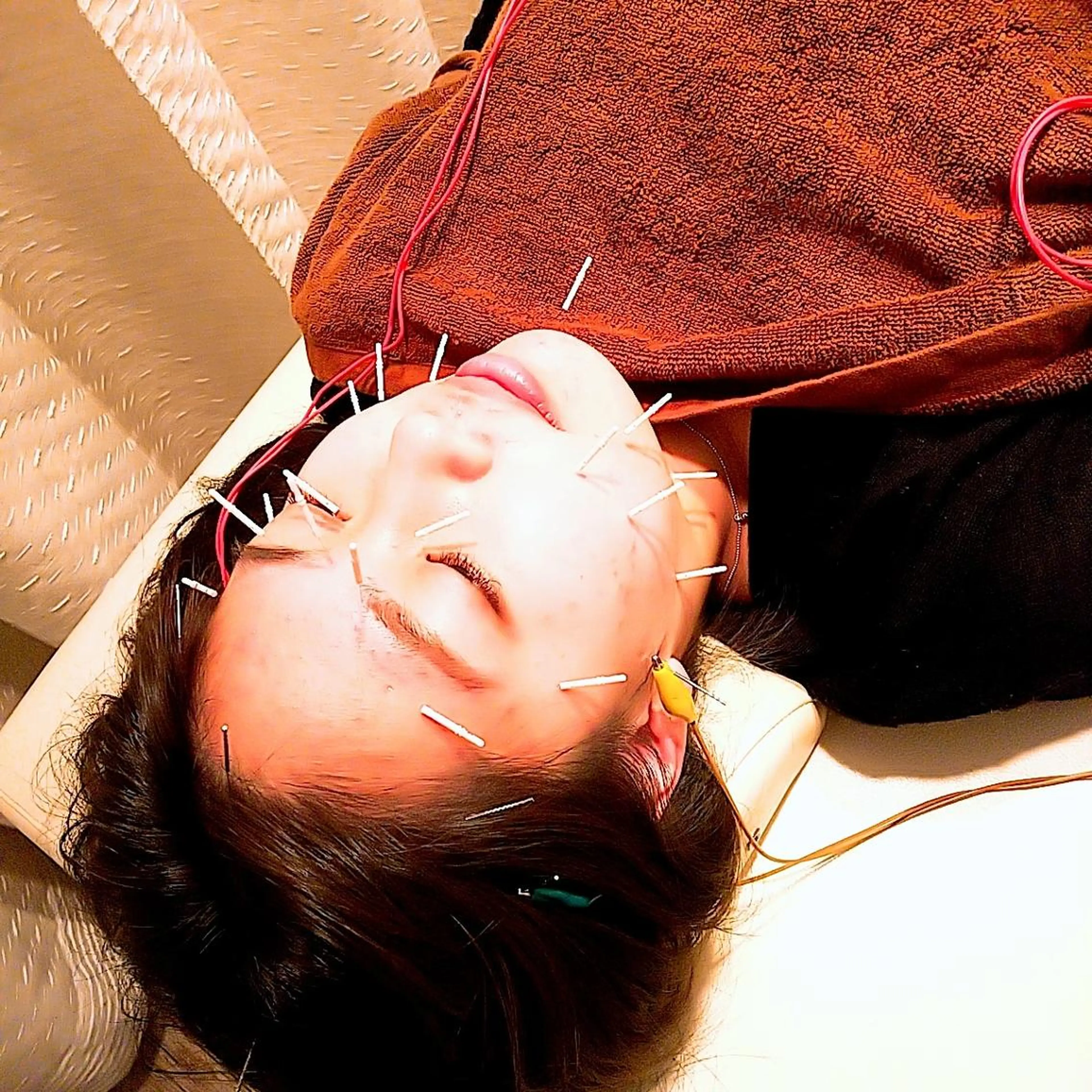 むくみたるみ専門☆ 美容鍼・小顔矯正のエステ・リラクイメージ