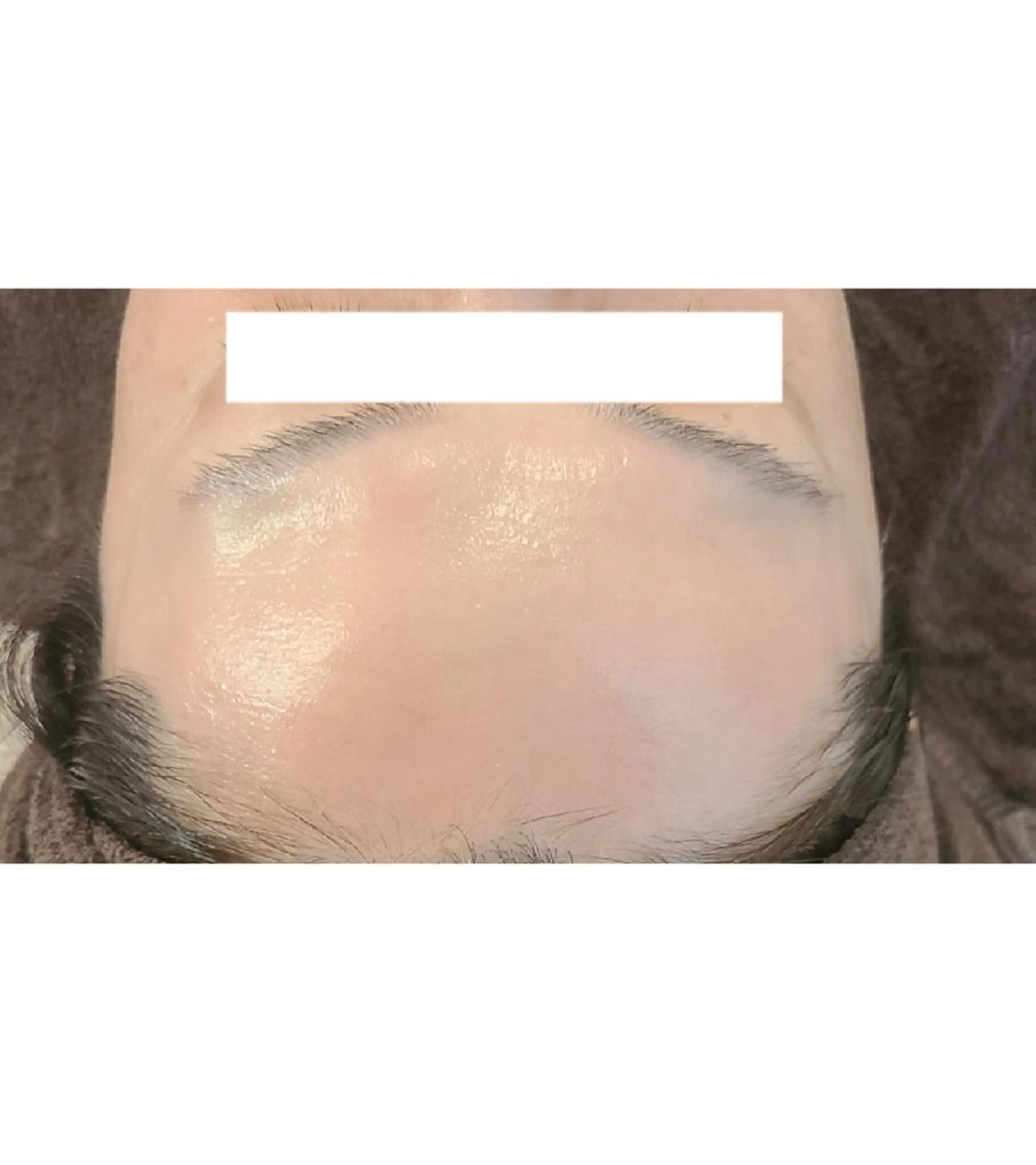 小顔矯正と最高級プラセンタ、ヒアルロン導入コースで憧れの小顔と美肌に導きます！デコルテ背面マッサージ付きの写真