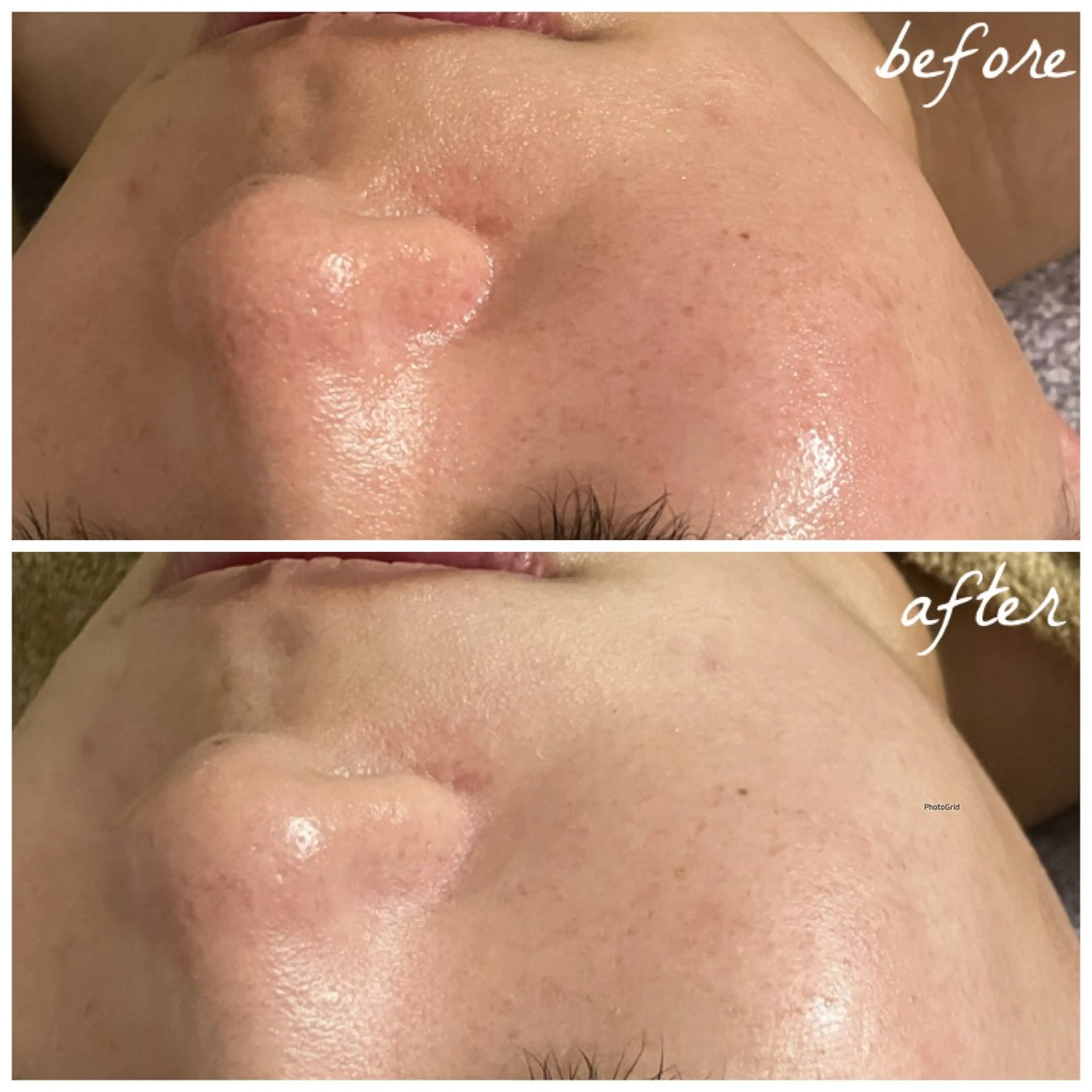 メンズ エステ メナード岐阜市茜部 杉浦のエステ・リラクイメージ