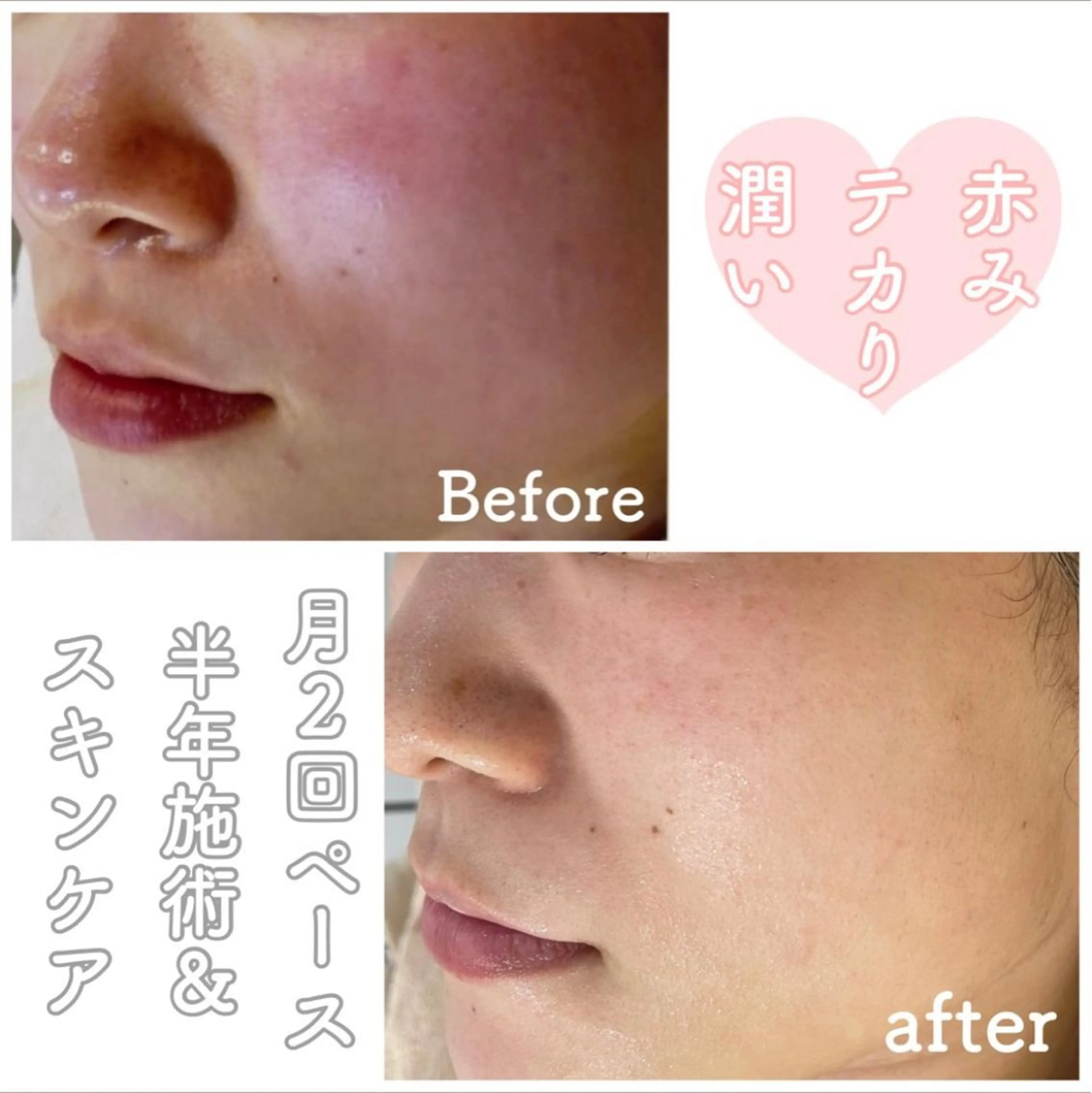 都度払い肌改善専門店 店長二上文香のエステ・リラクイメージ