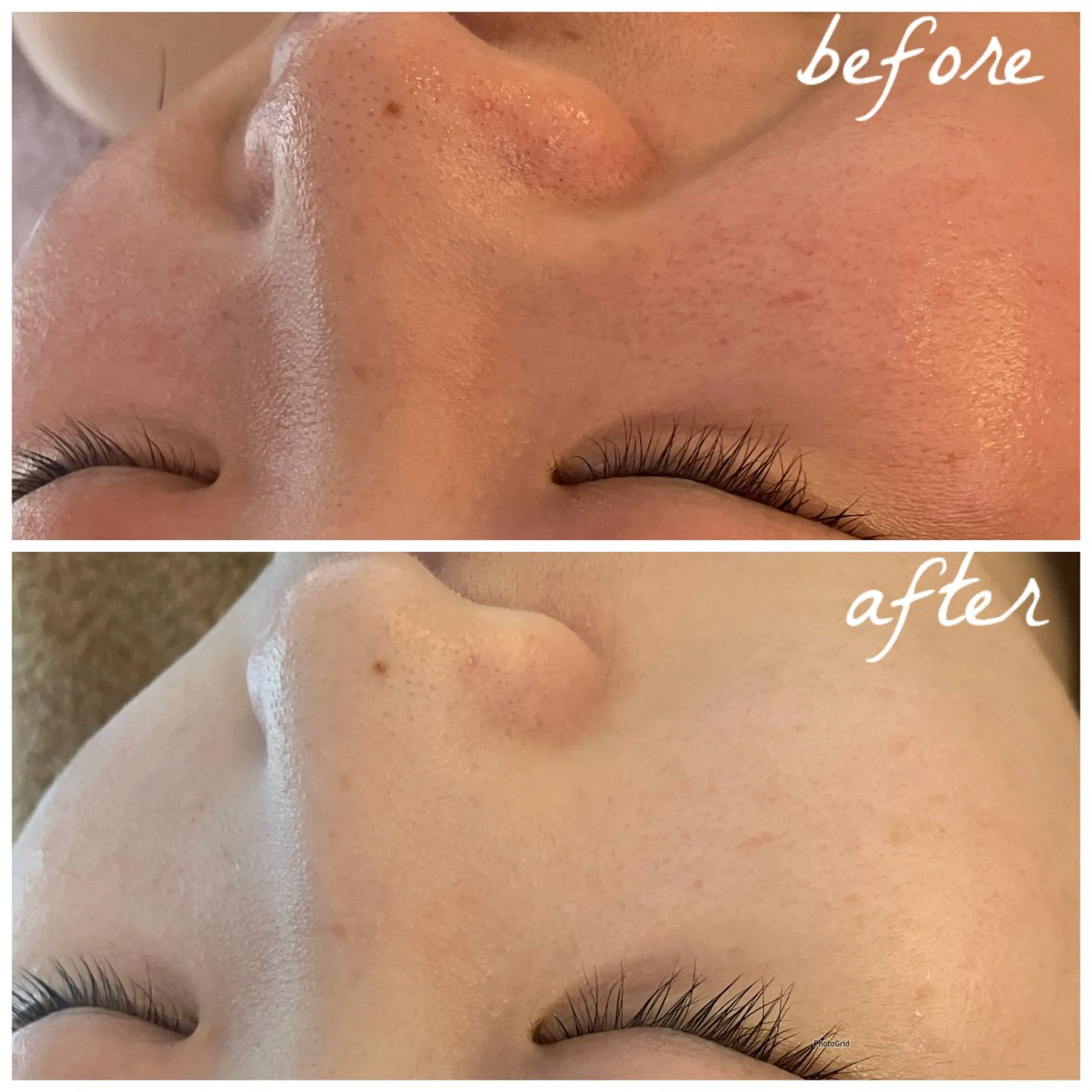 メンズ エステ メナード岐阜茜部 杉浦のエステ・リラクイメージ