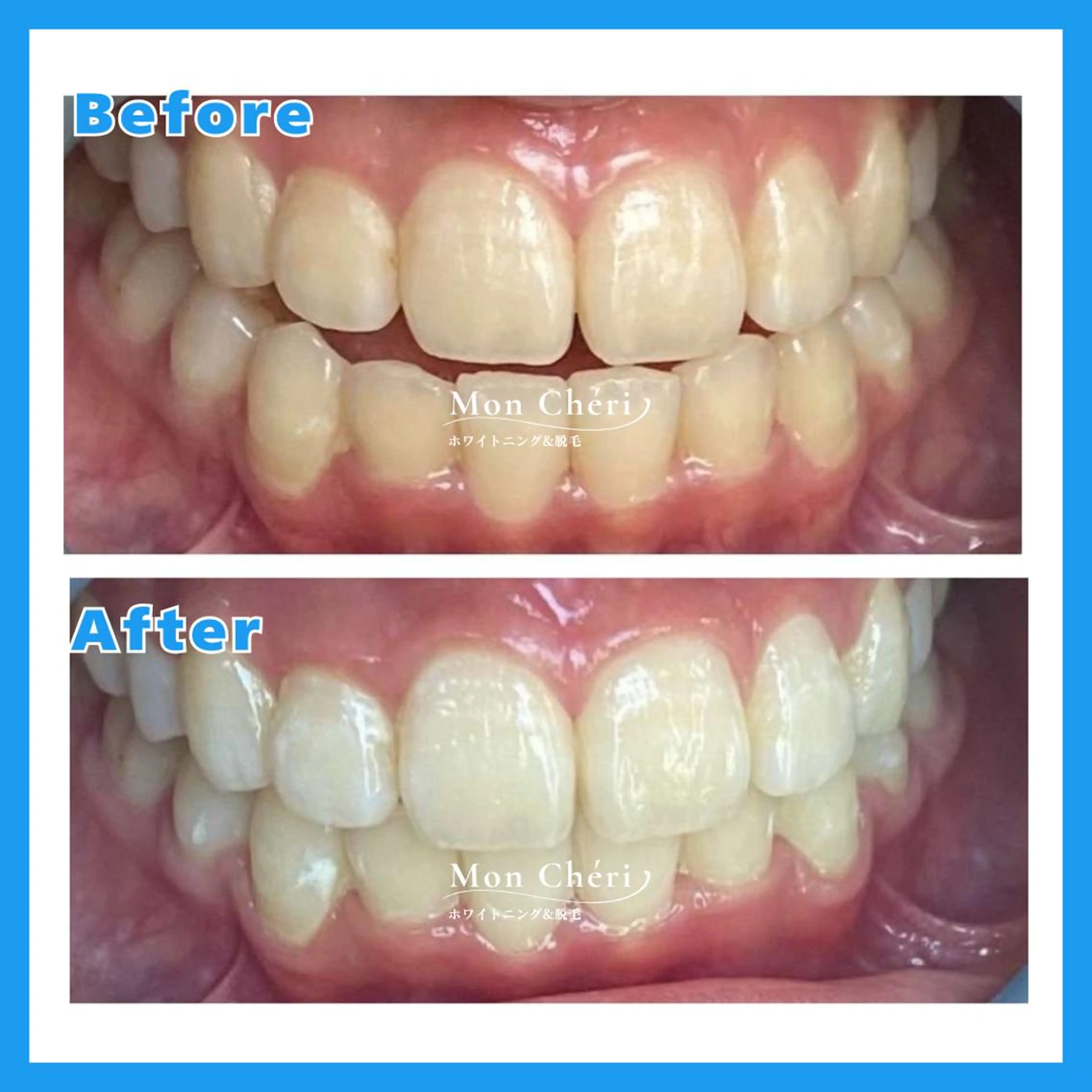 エステ Mon Cheri 広島店のエステ・リラクイメージ