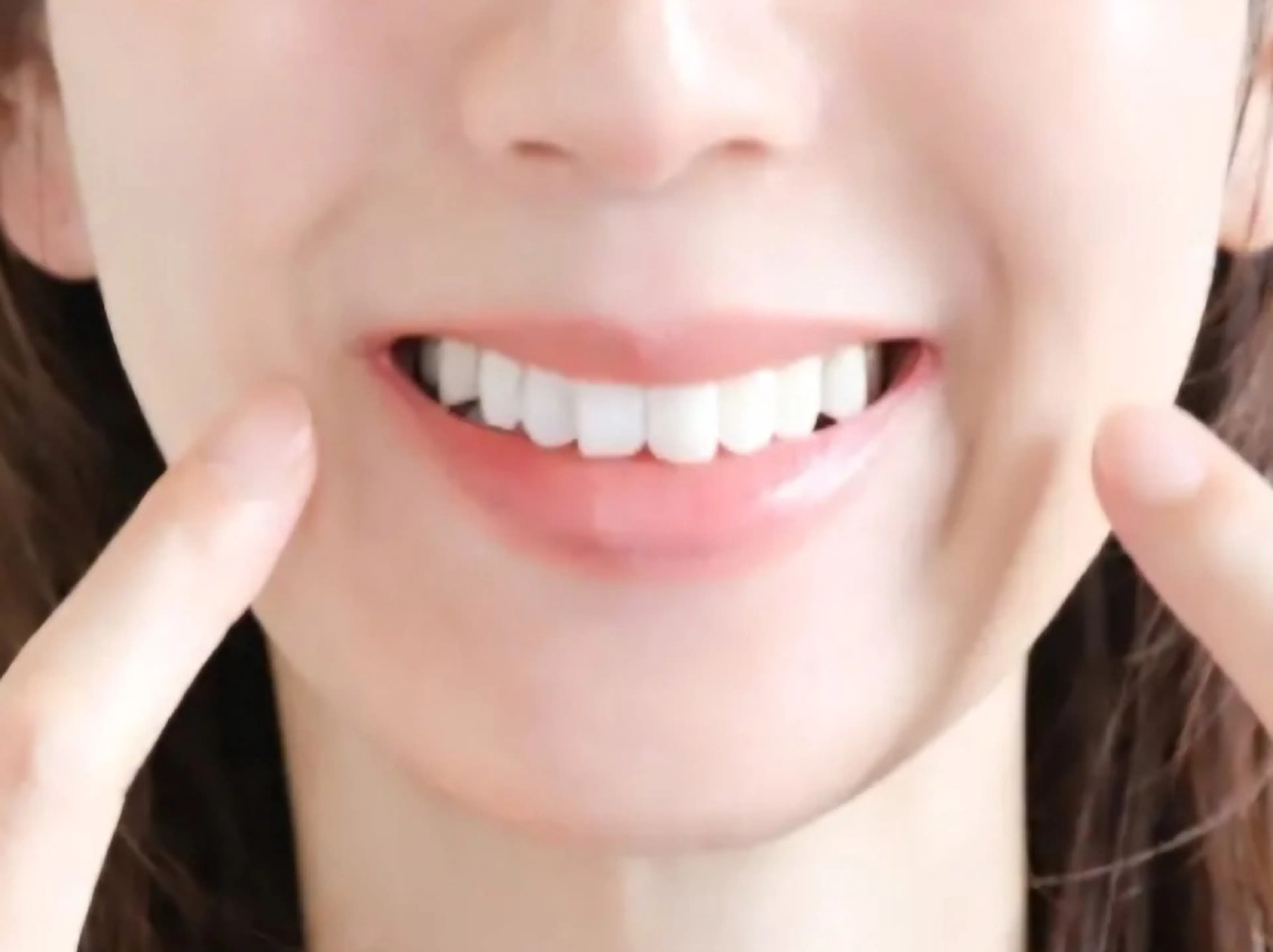 【ミニモ学割】セルフホワイトニングの写真