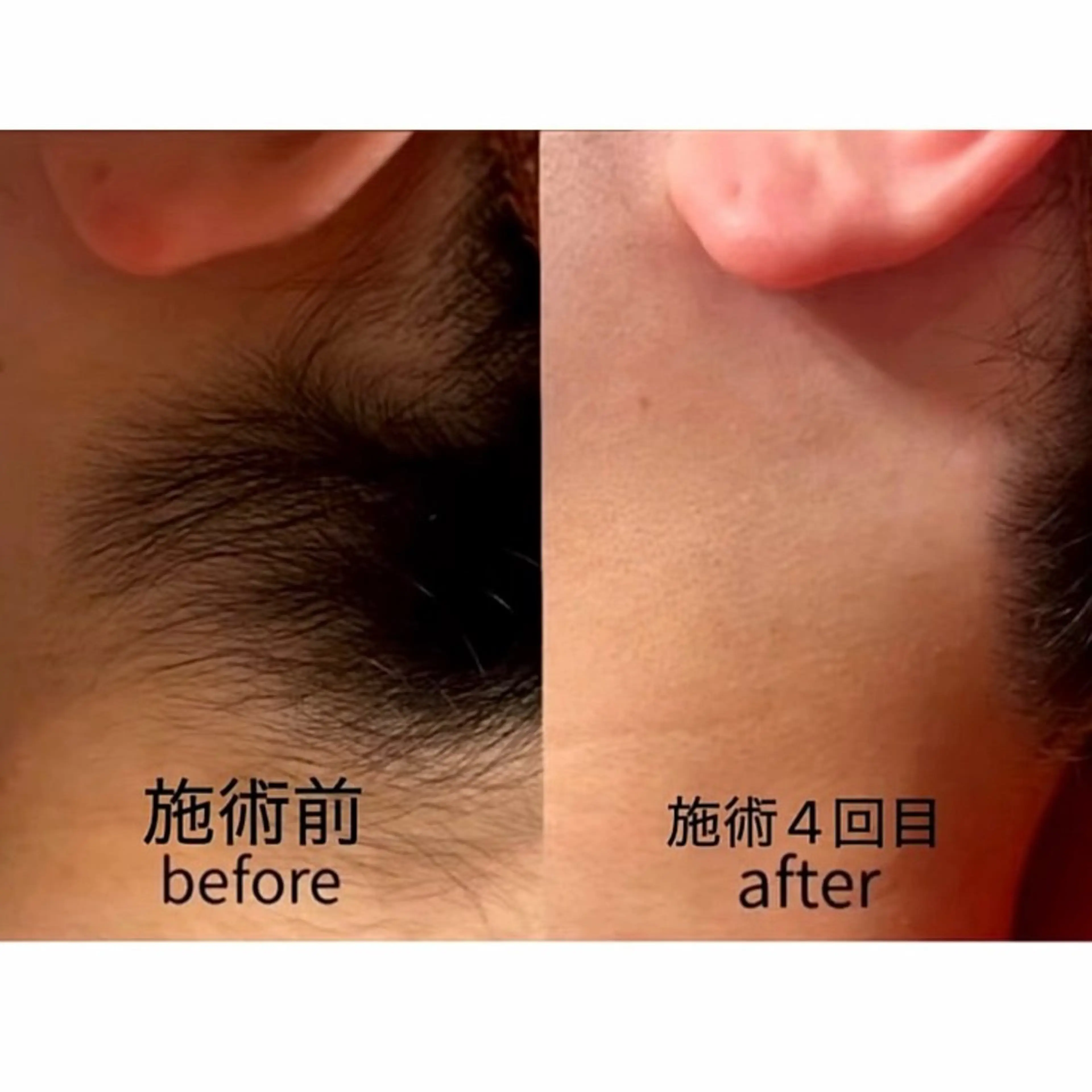 脱毛 KA PILINAのエステ・リラクイメージ