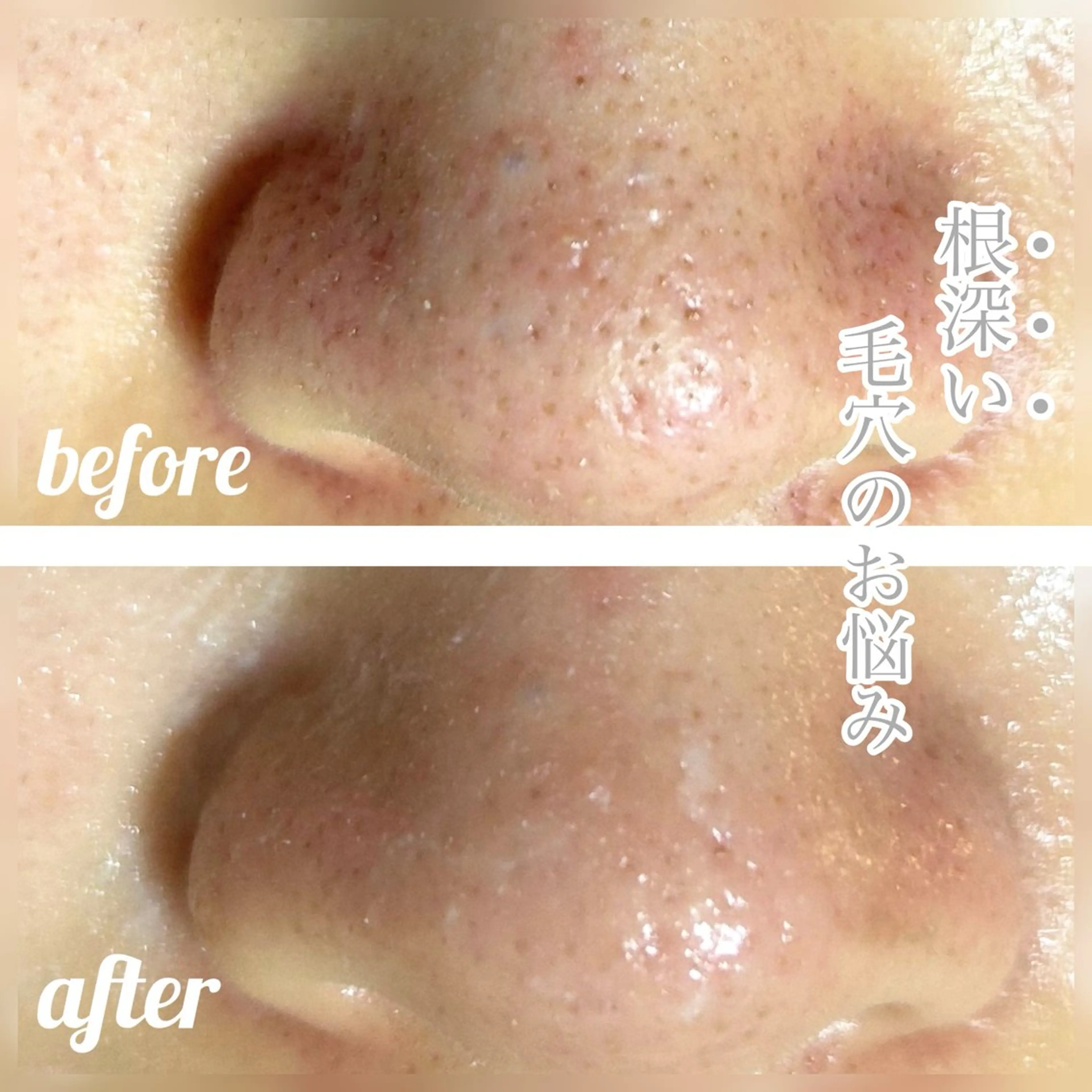 エステ ホワイト ターコイズのエステ・リラクイメージ