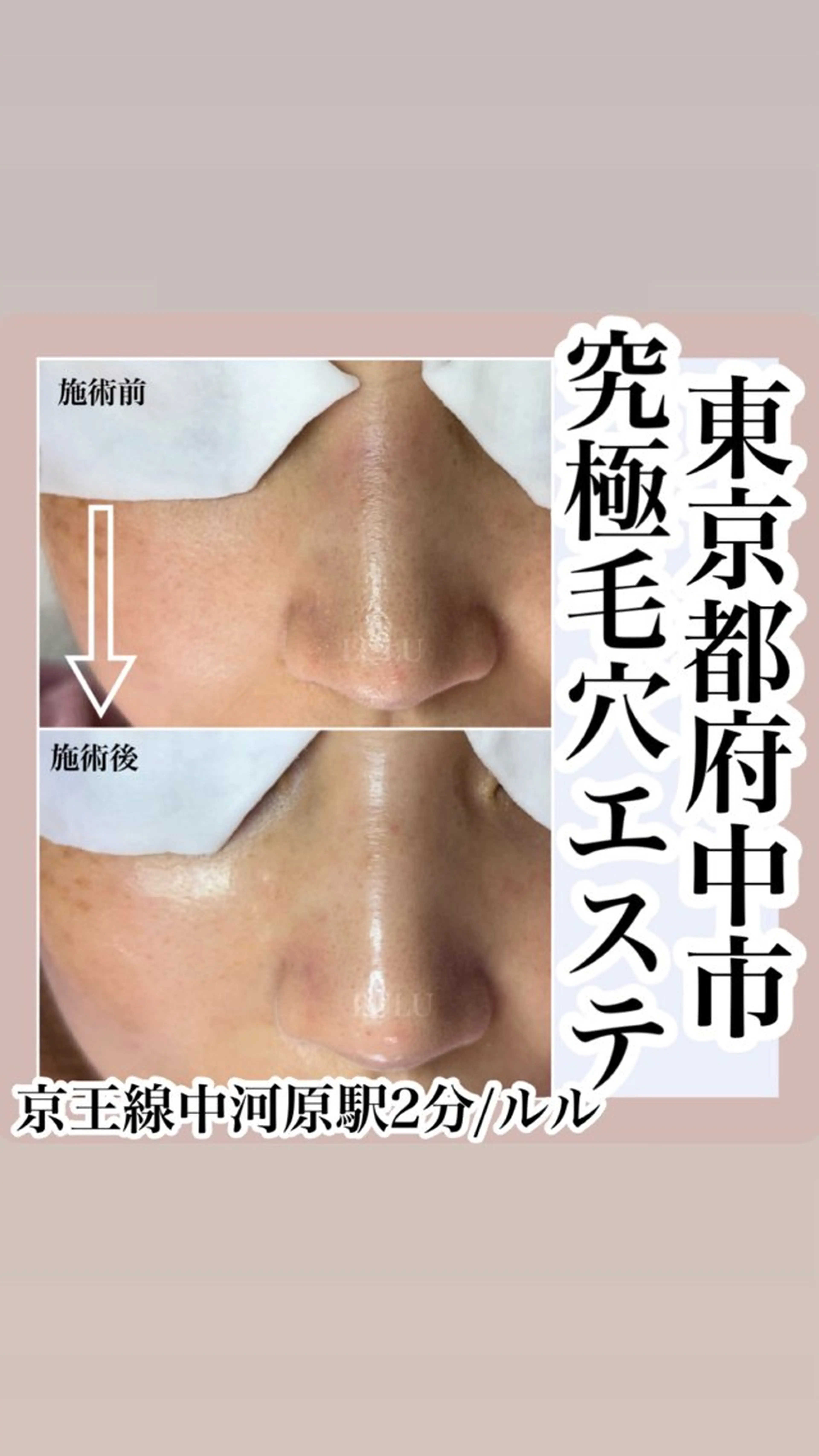 エステ LULU ルルのエステ・リラクイメージ