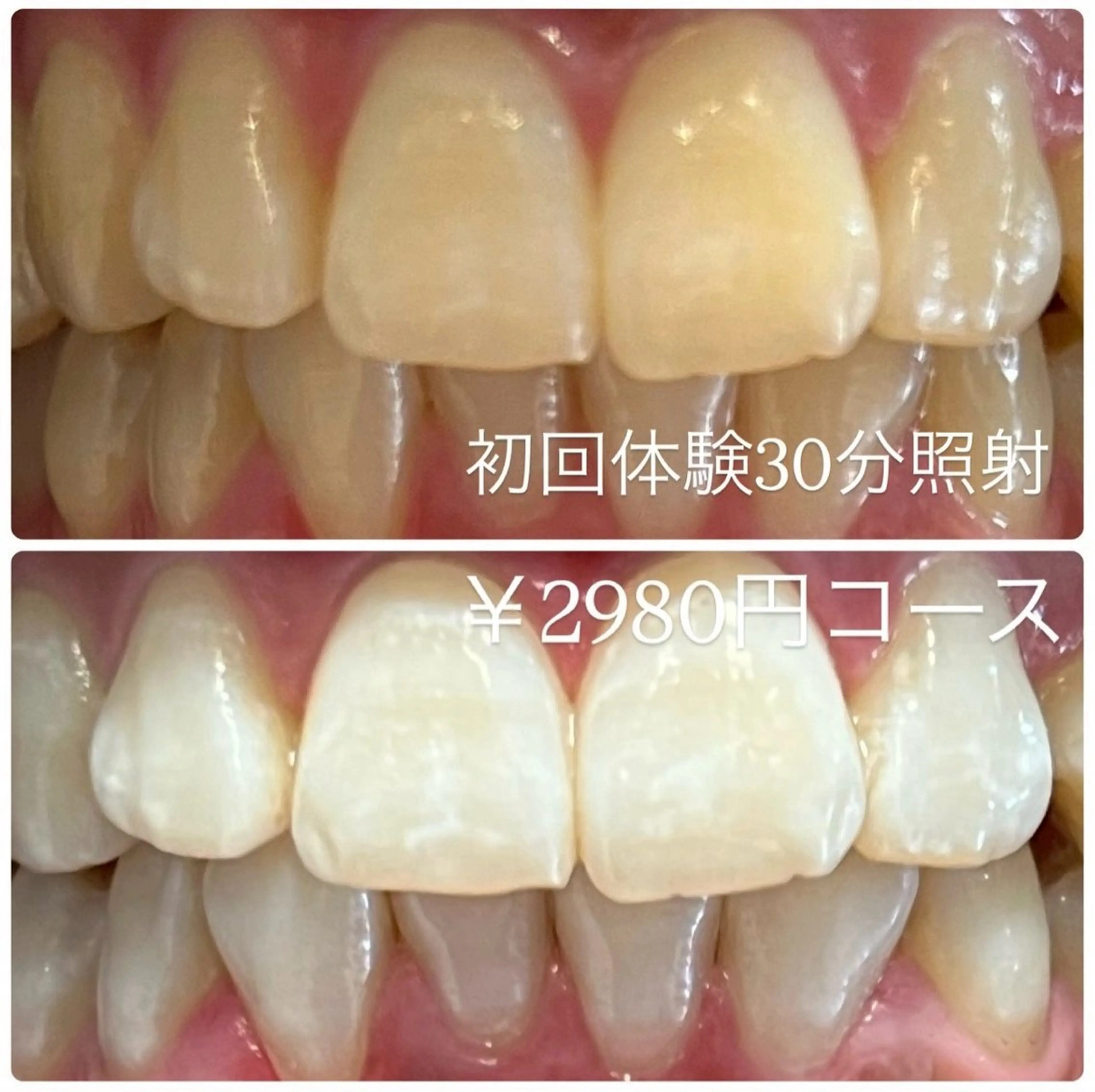 メンズ ホワイトニング ルーム　川崎店のその他イメージ