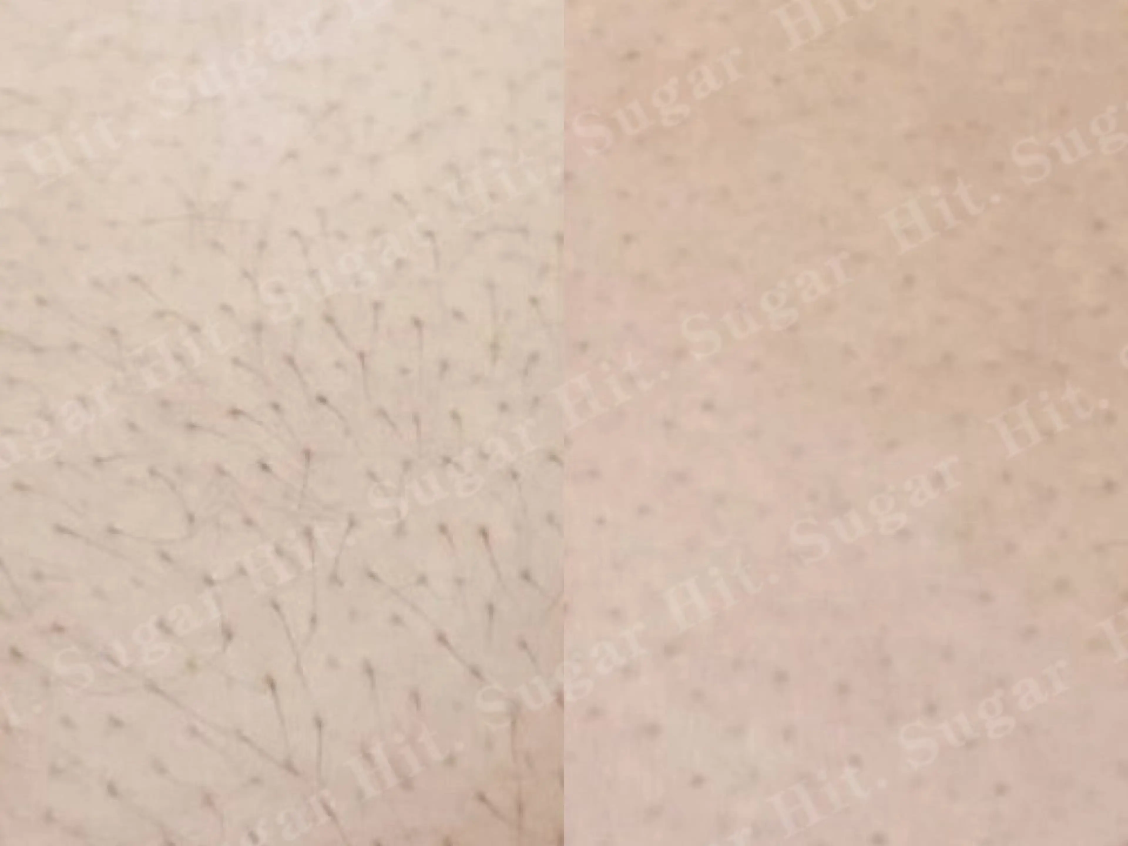 Hitomi シュガーリング豊橋のその他イメージ