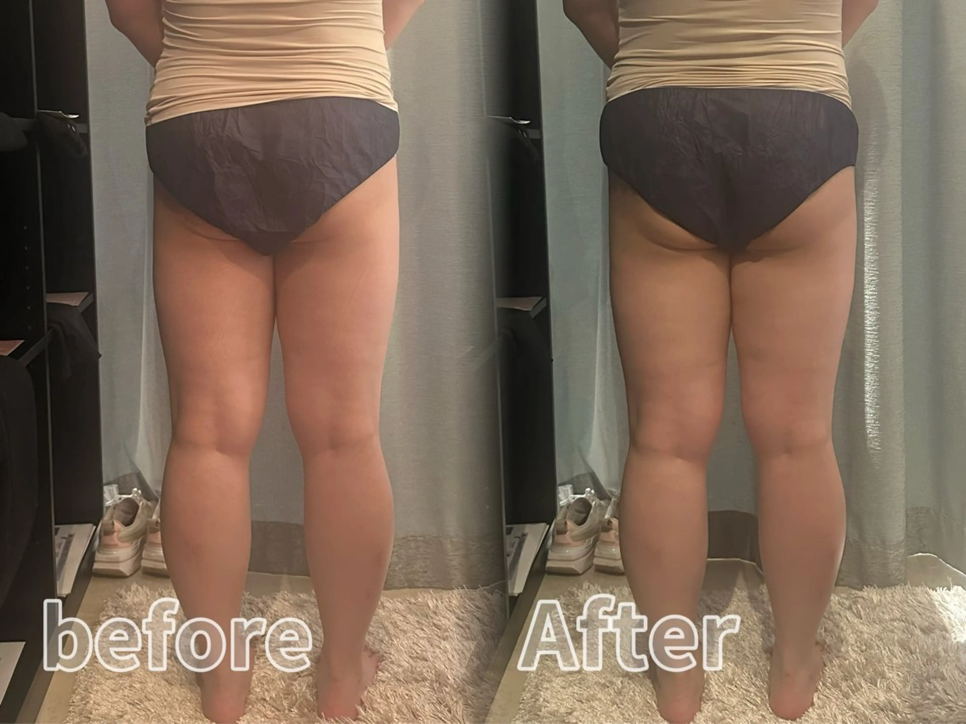 エステ 浮腫|肩こり|張り 日々の疲れを解消★のエステ・リラクイメージ