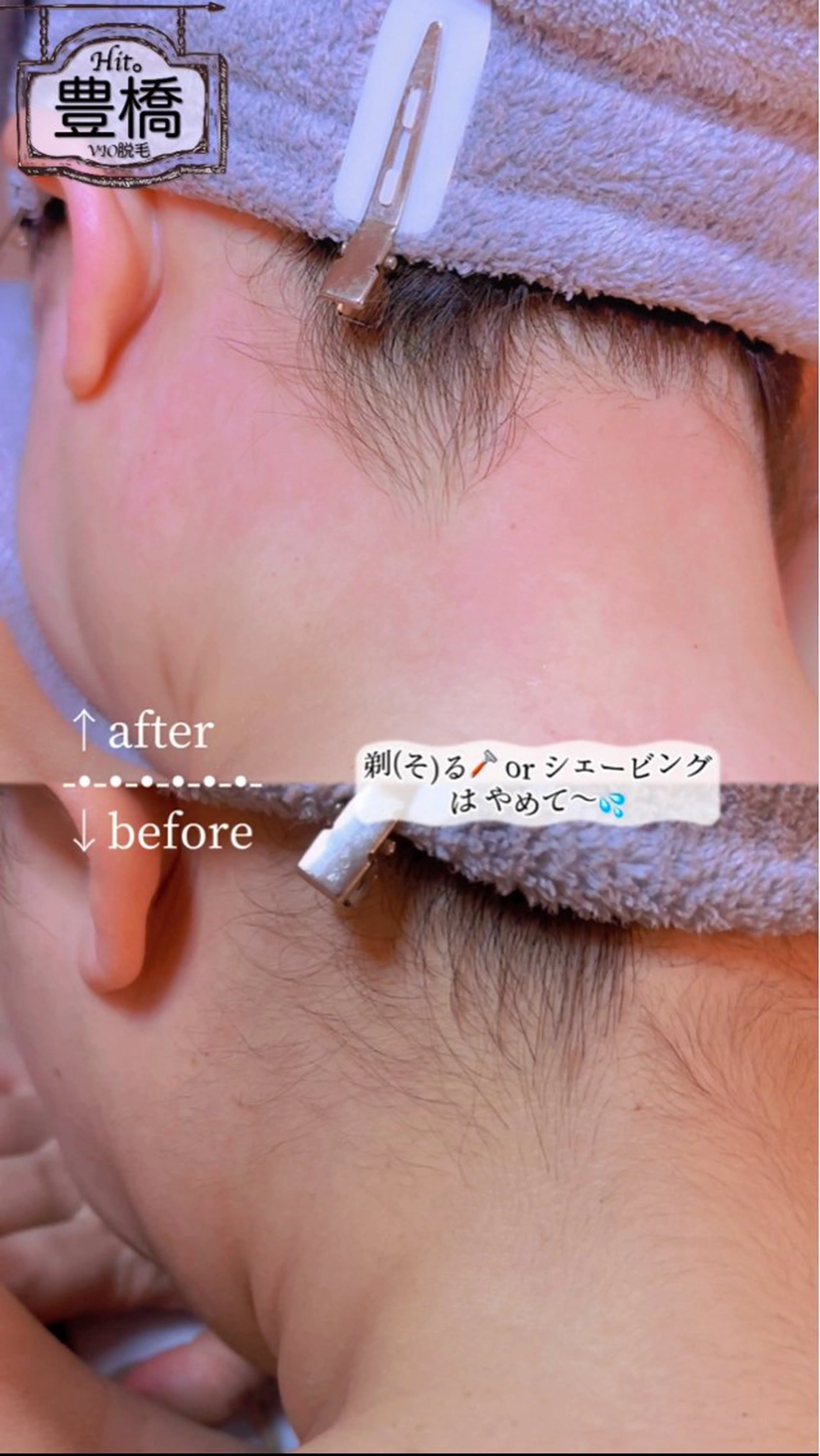 Hitomi シュガーリング豊橋のその他イメージ