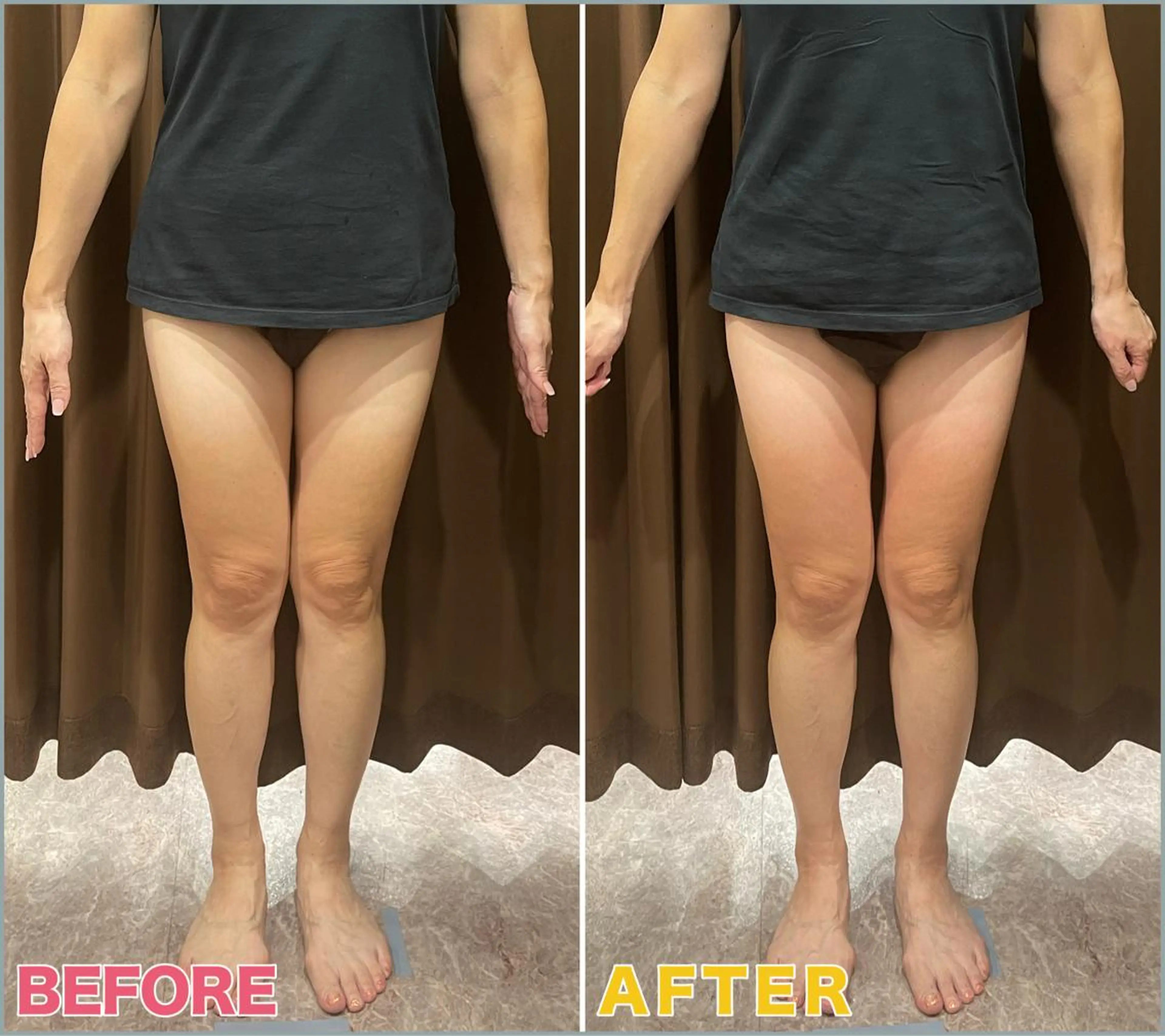 VIVACE YUMEのその他イメージ