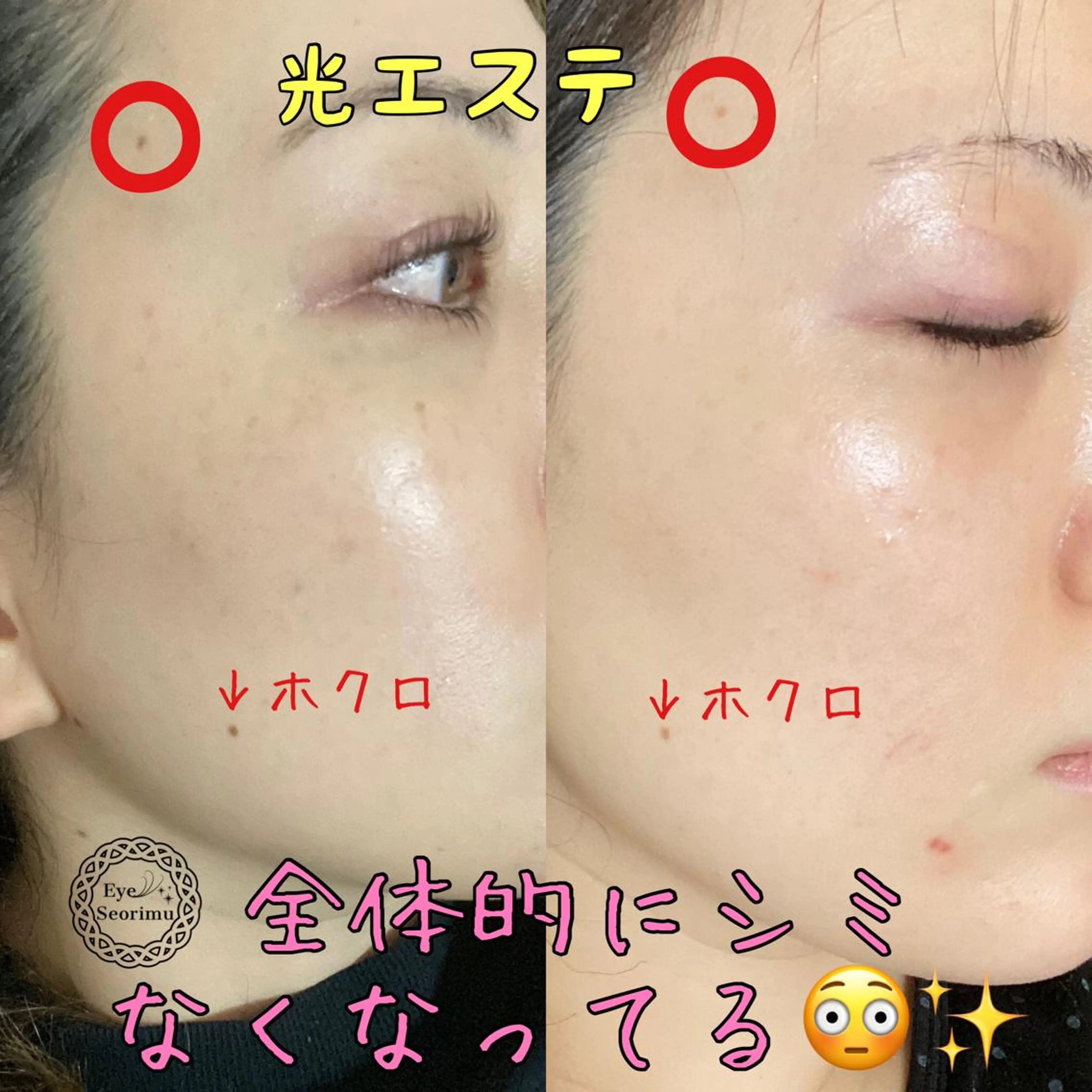 Rim リムのマツエク・マツパデザイン