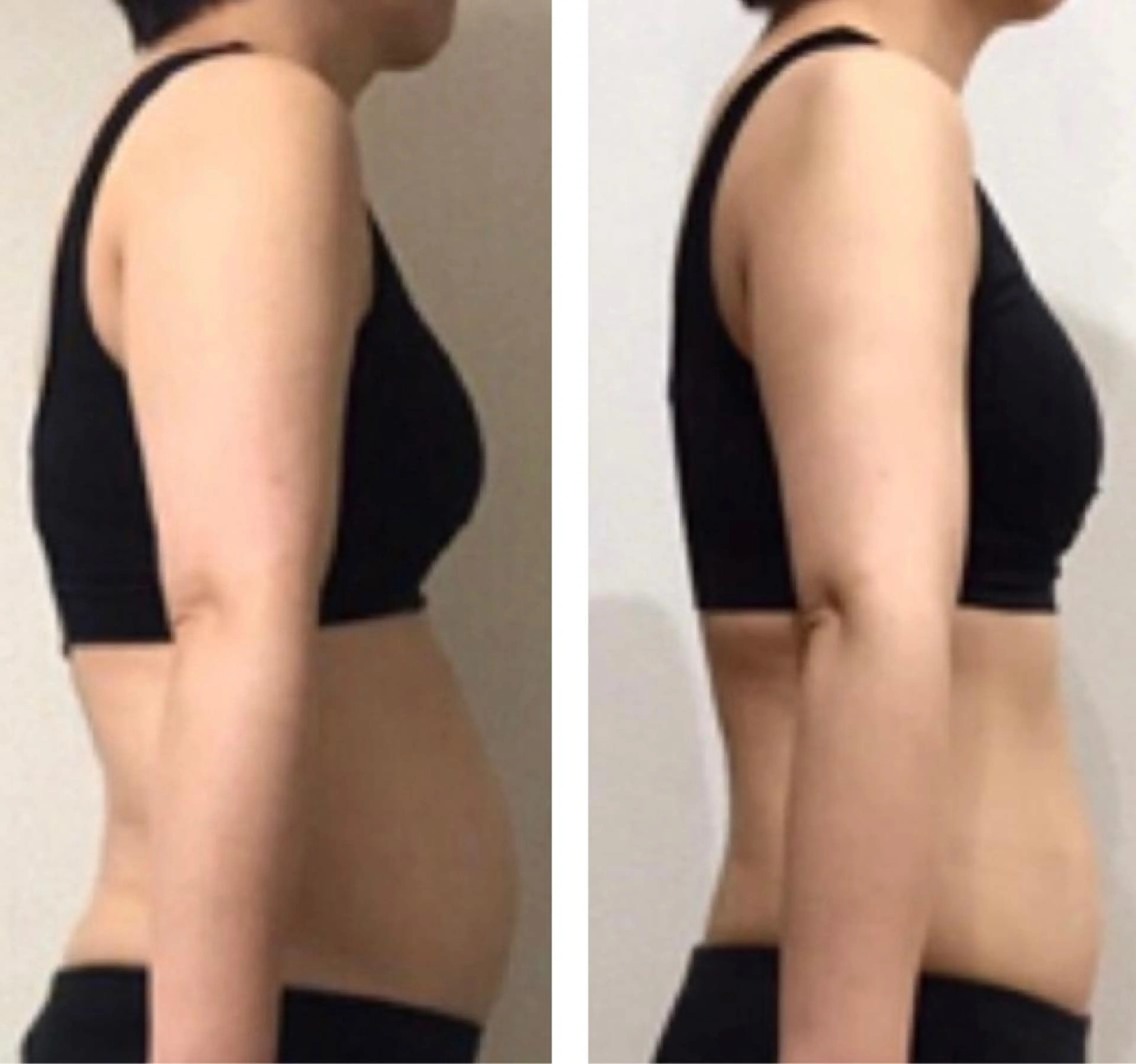 🌈女性限定🌈 気になるお腹まわりを集中的にケア✨の写真