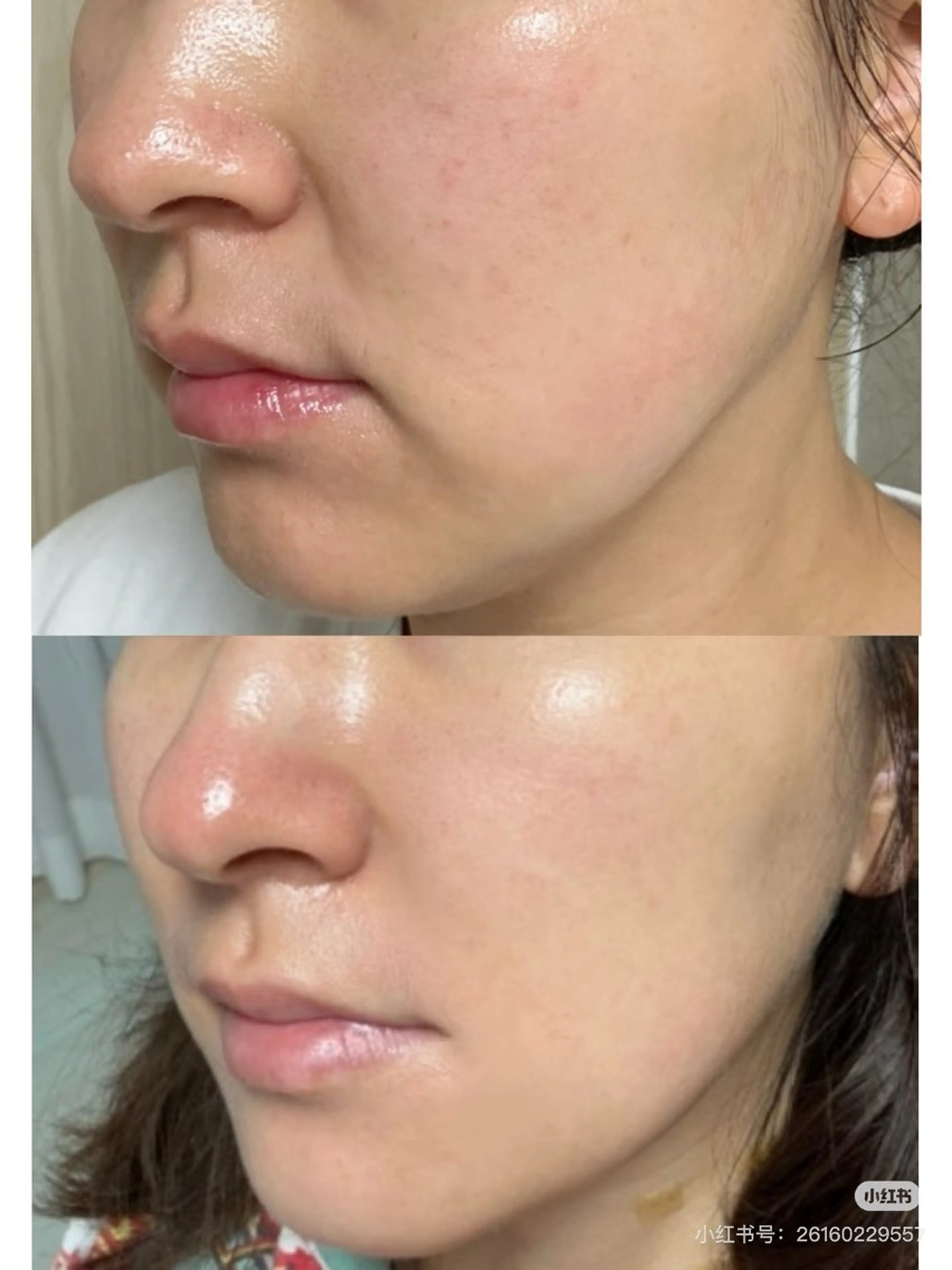 マツエク・マツパ エステ aliaハーブ水光店 エステティシャン募集のエステ・リラクイメージ