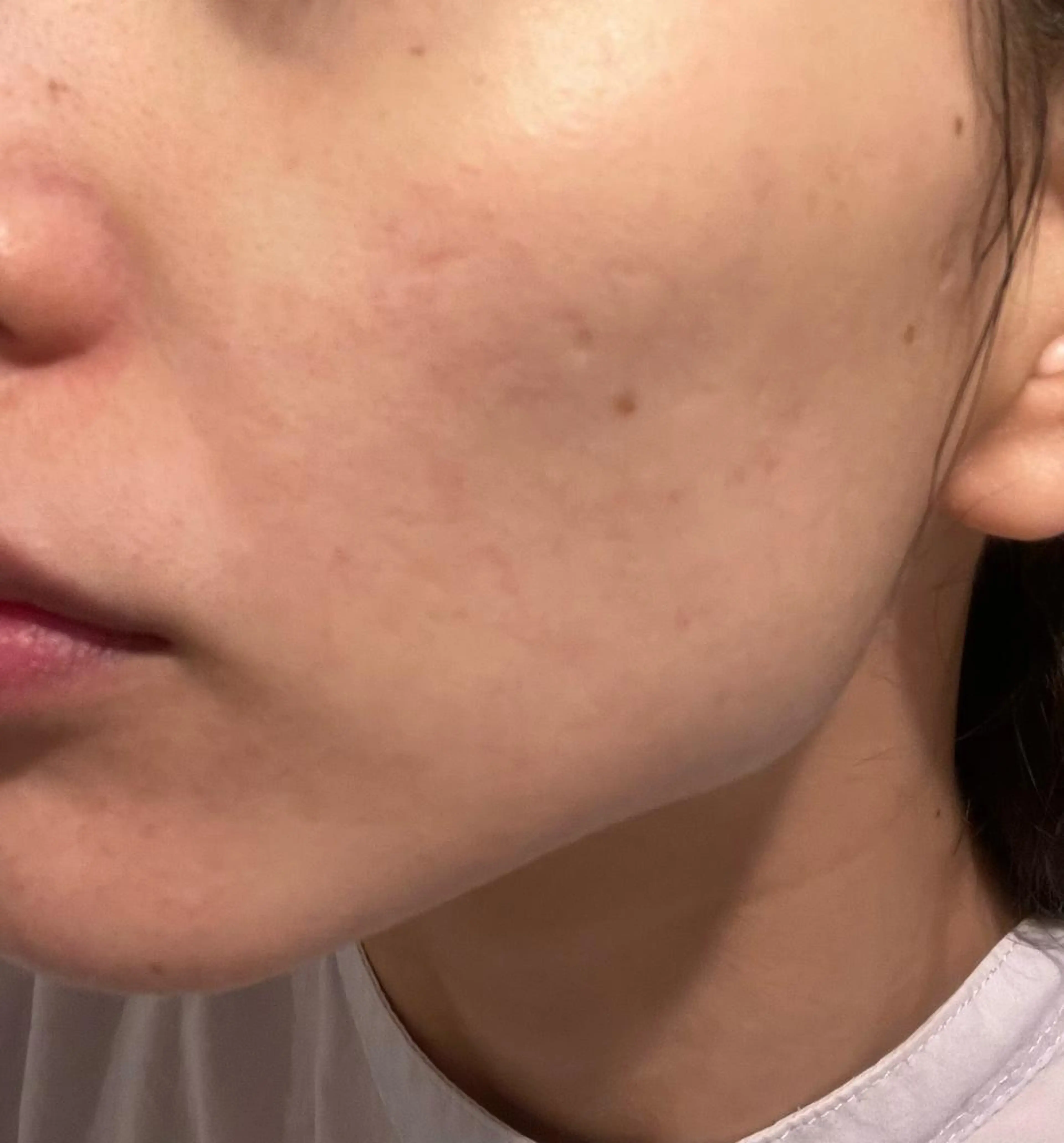 脱毛SALON RaYNiCKのエステ・リラクイメージ