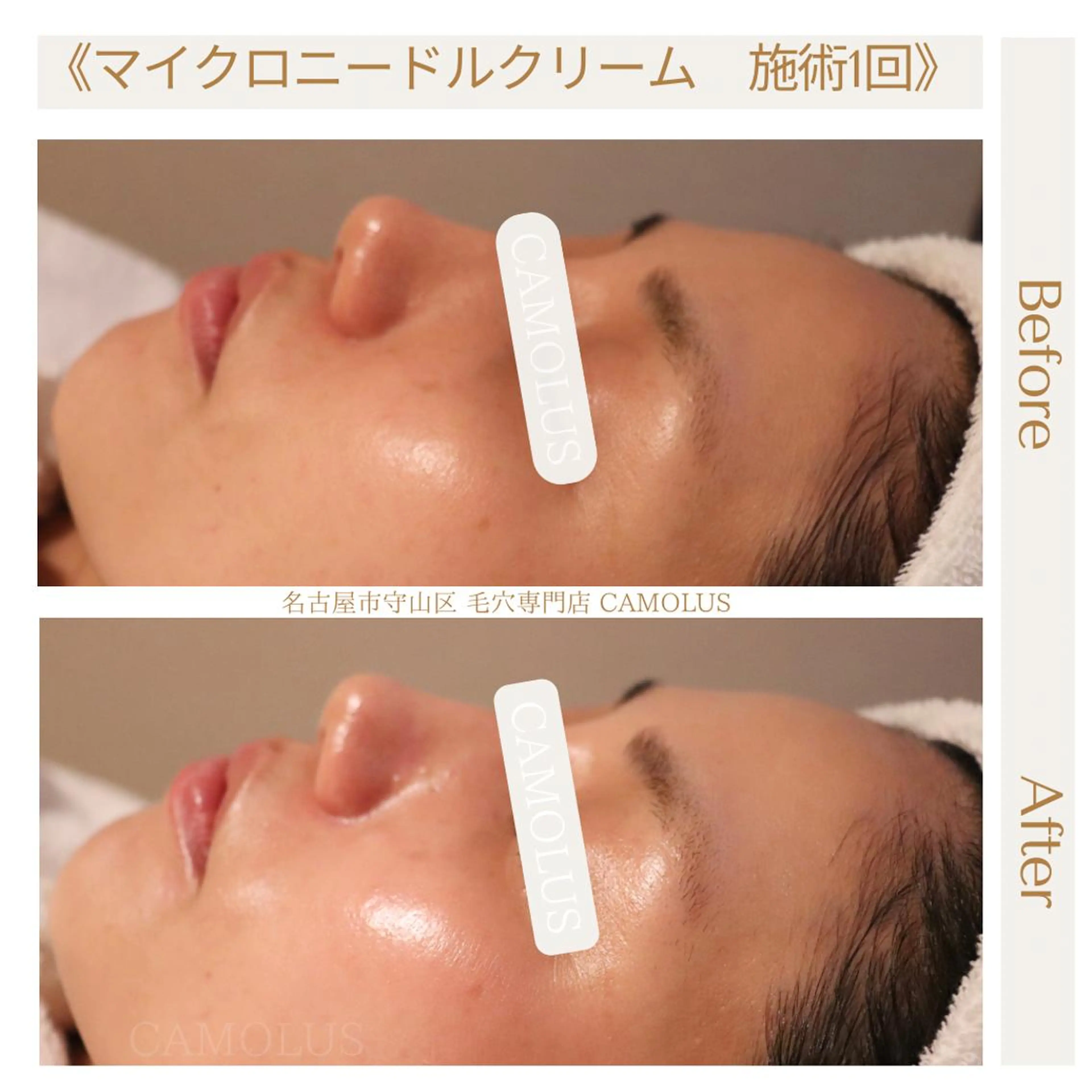 エステ SUZUKI SHURIのエステ・リラクイメージ