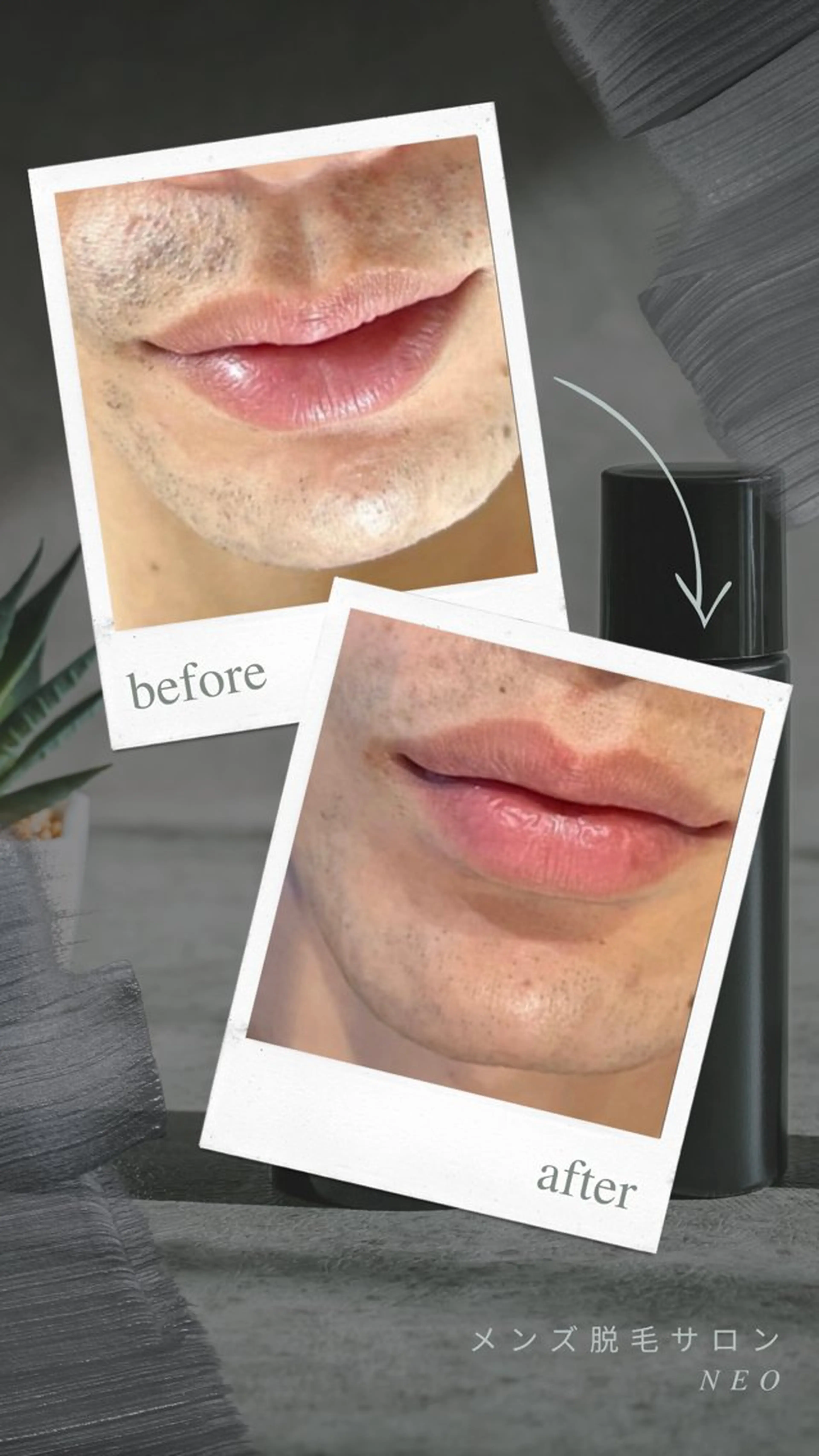 メンズ 脱毛 メンズ脱毛サロン NEOのエステ・リラクイメージ