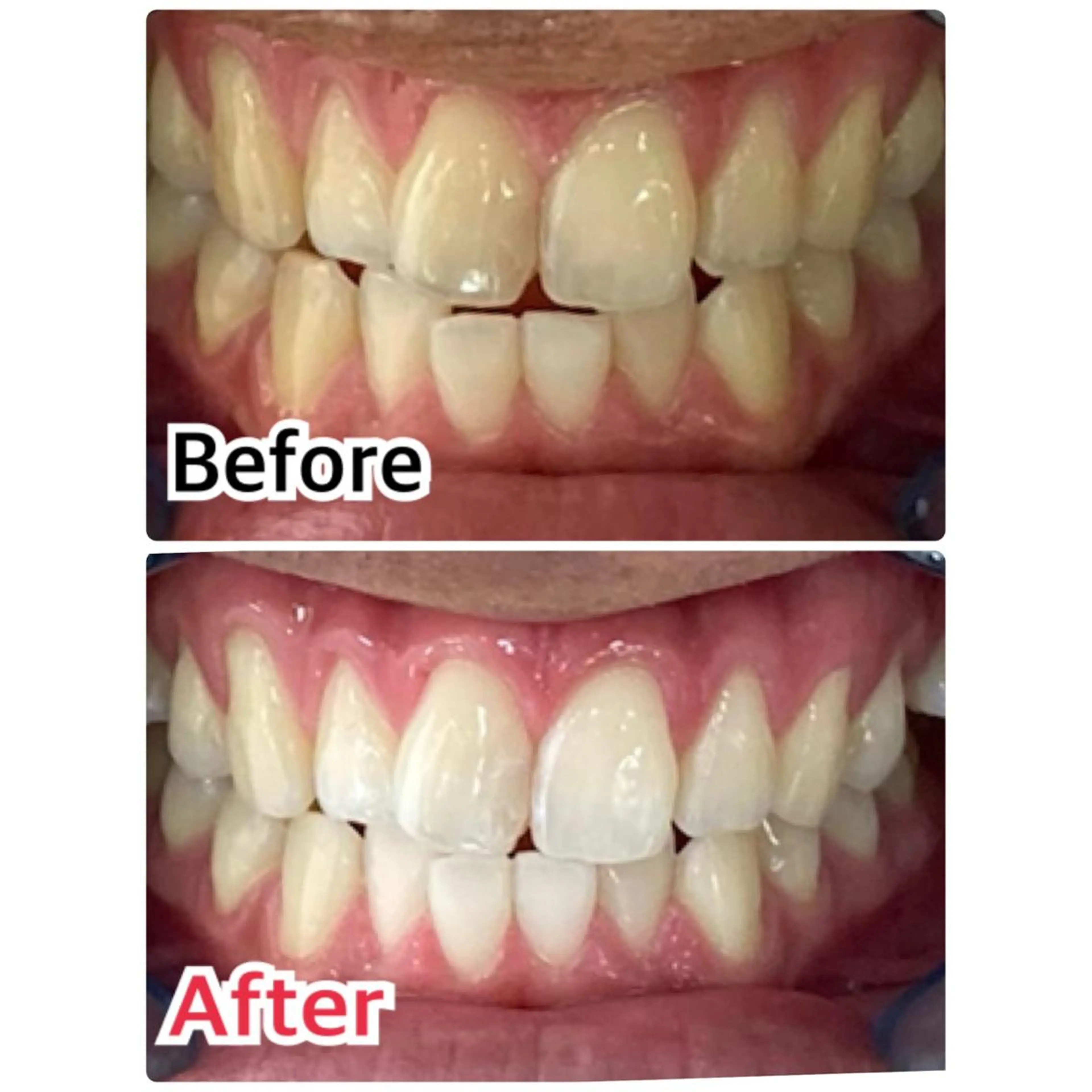 メンズ プラチナムビューティー柏所属・【歯科提携】柏ホワイ トニングスタイルのその他イメージ