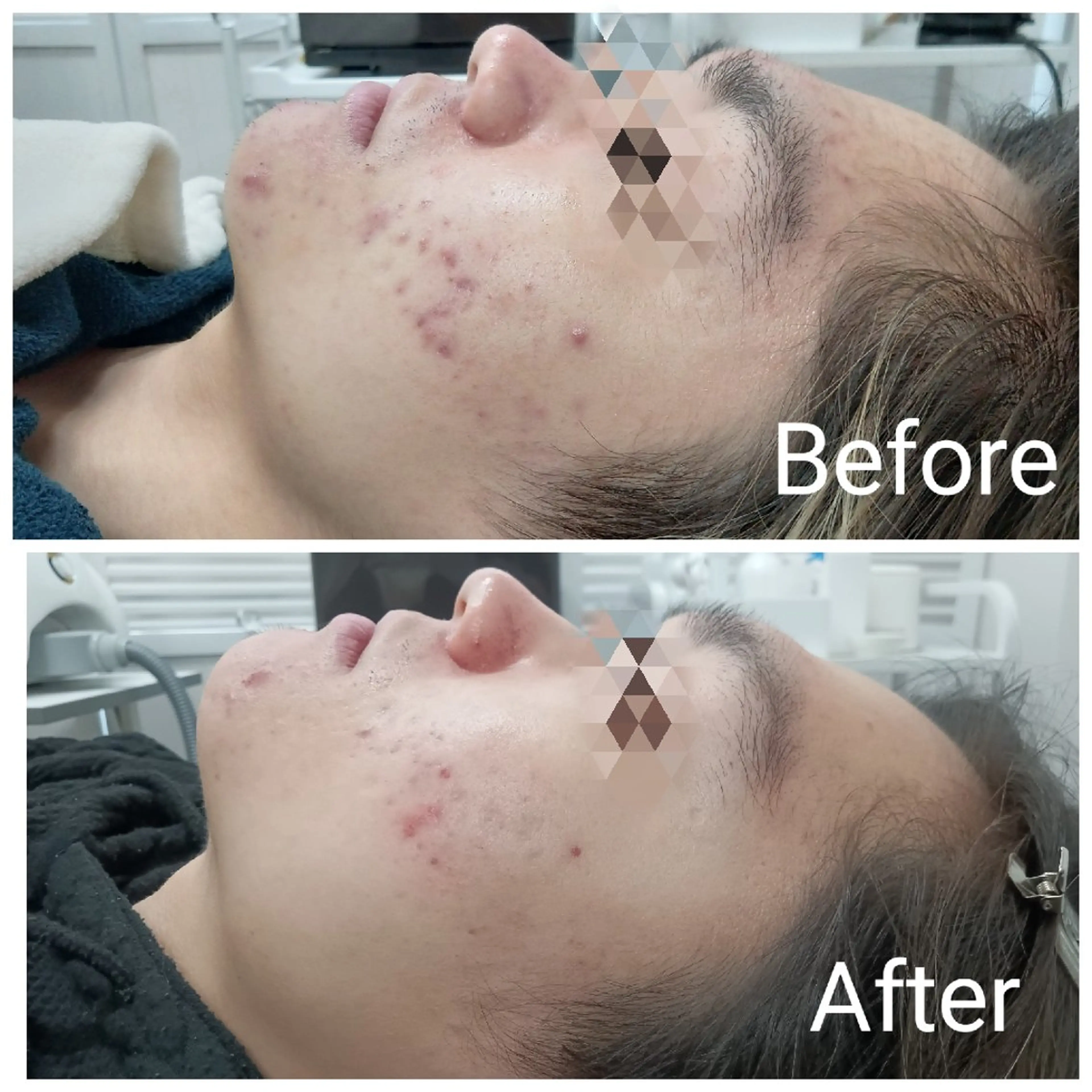 エステ リラク 肌質改善Beauty salon Renのエステ・リラクイメージ