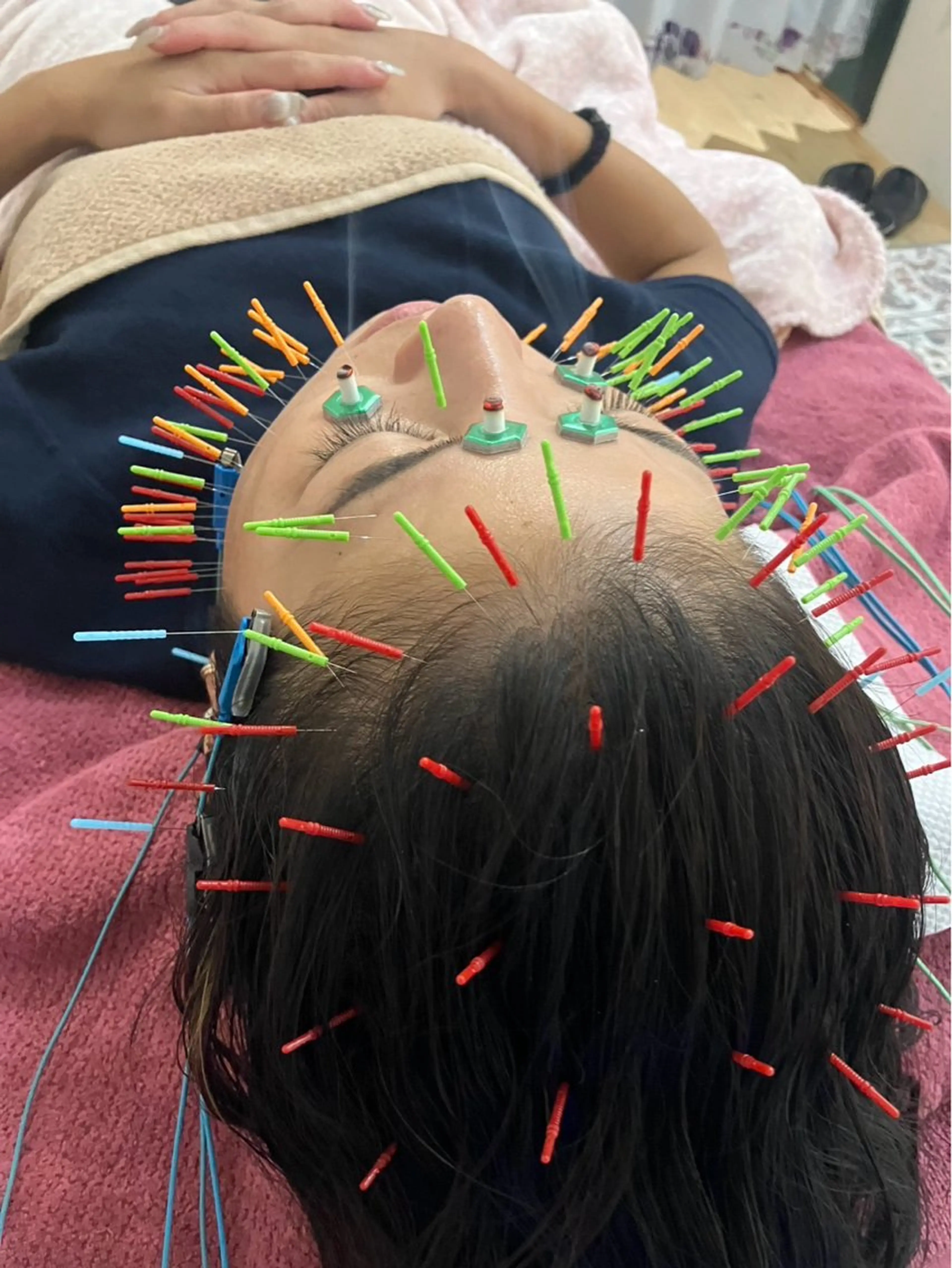 エステ リラク 美容鍼灸女性専用 りんご鍼灸治療院のその他イメージ