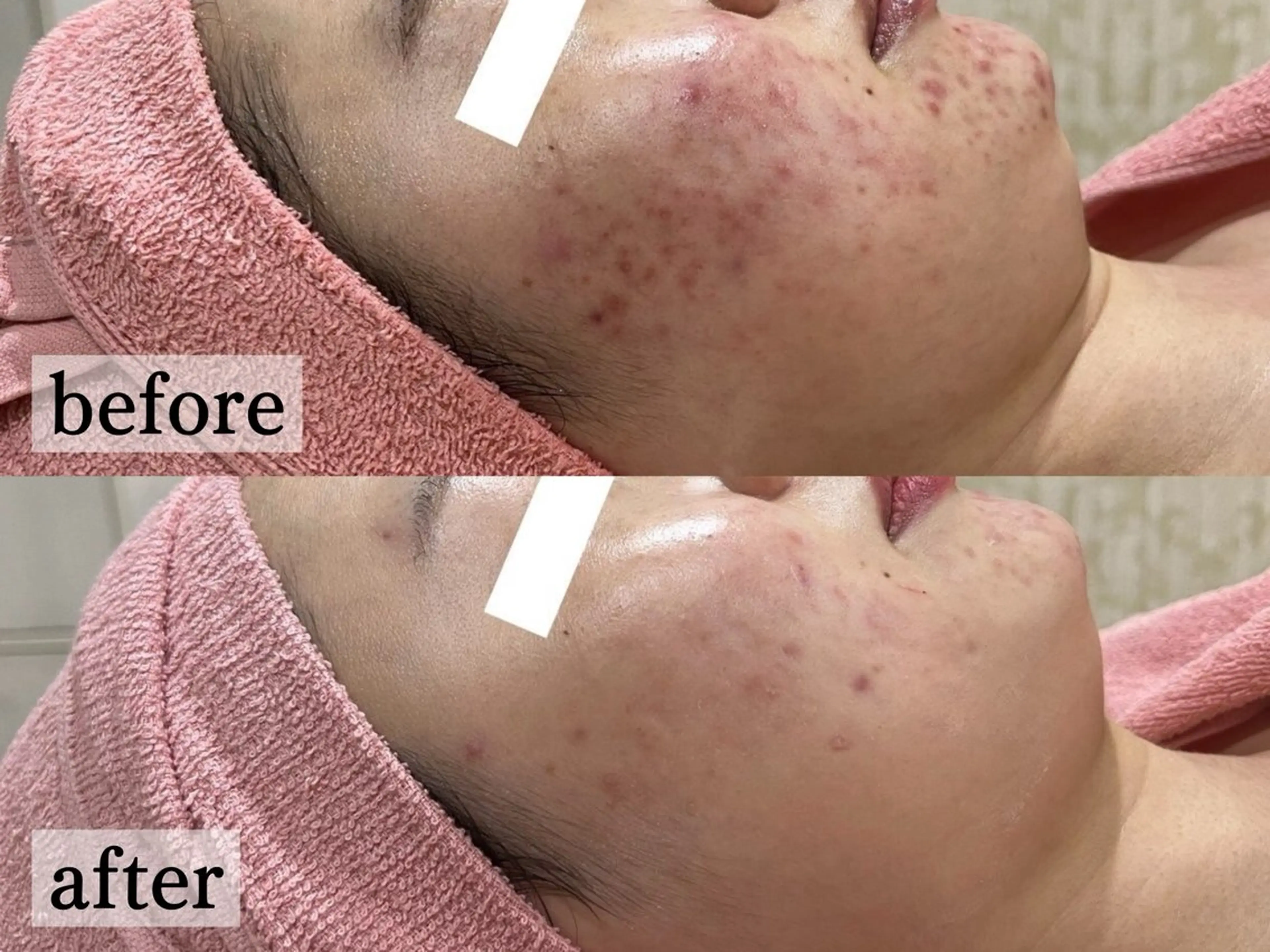 エステ フェイシャル/脱毛 ジョアアンジェ竹田のエステ・リラクイメージ