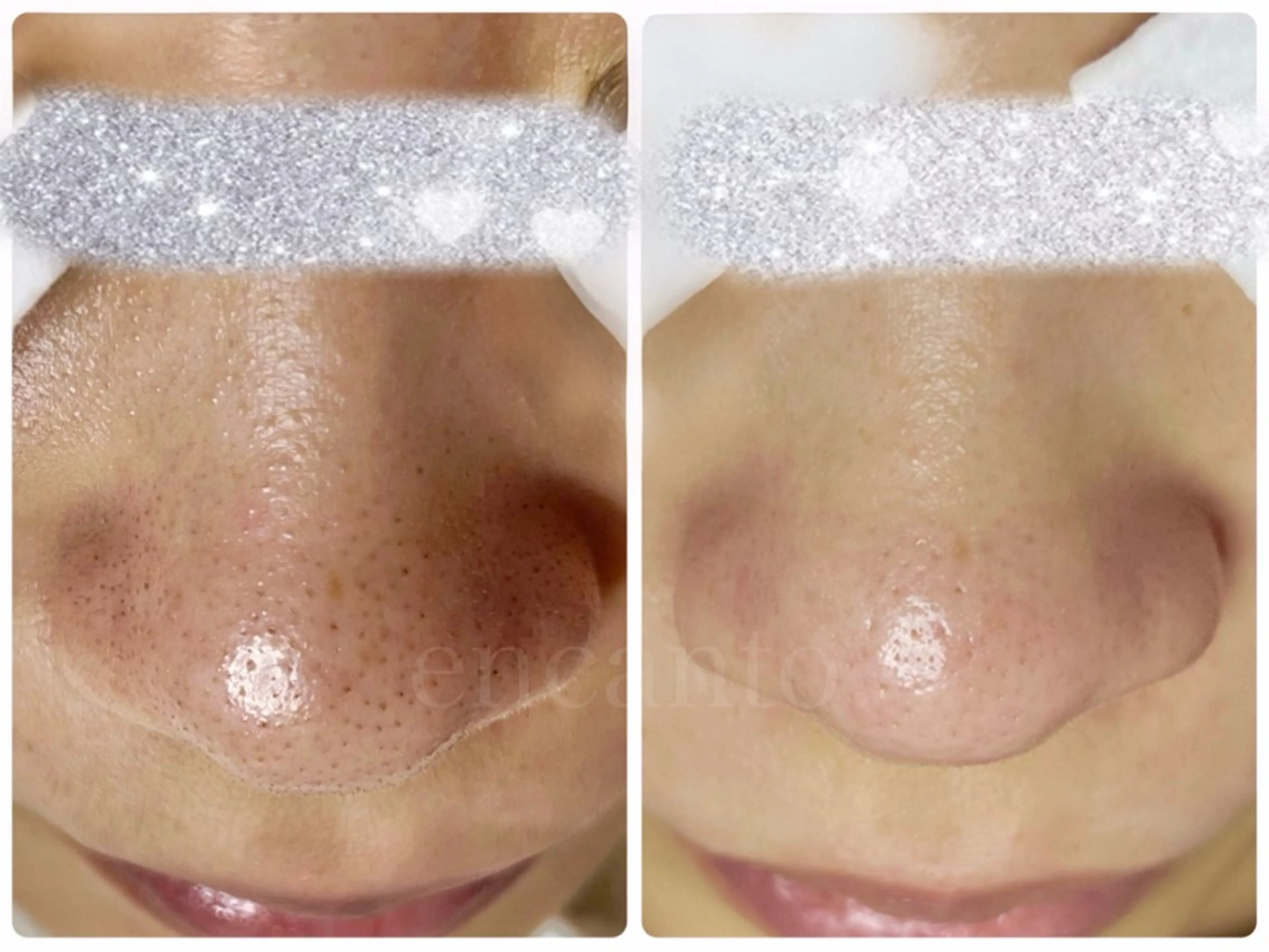 エステ 杉本 里保のその他イメージ