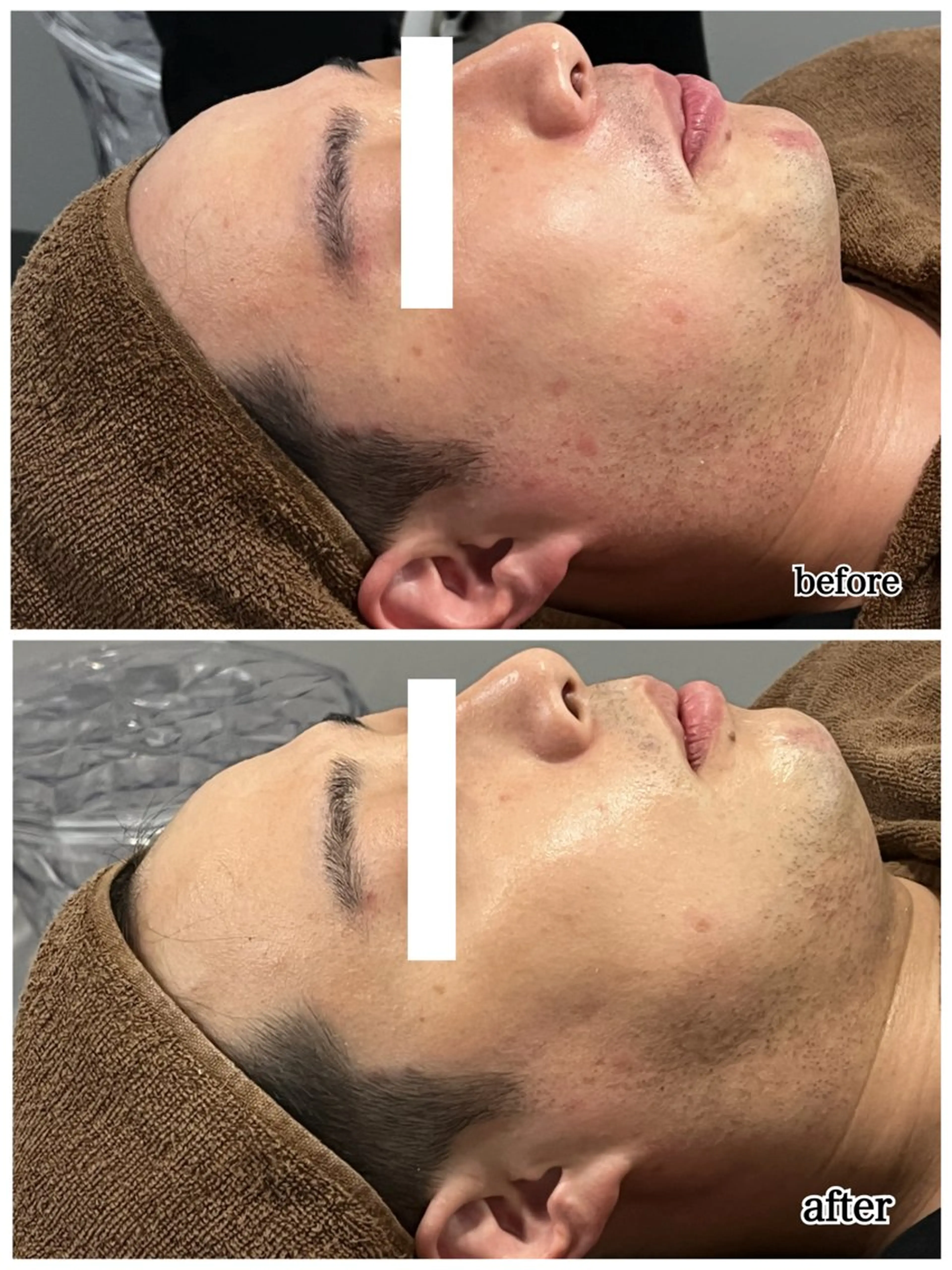 その他 ENCHANT Kaede/肌質改善のその他イメージ