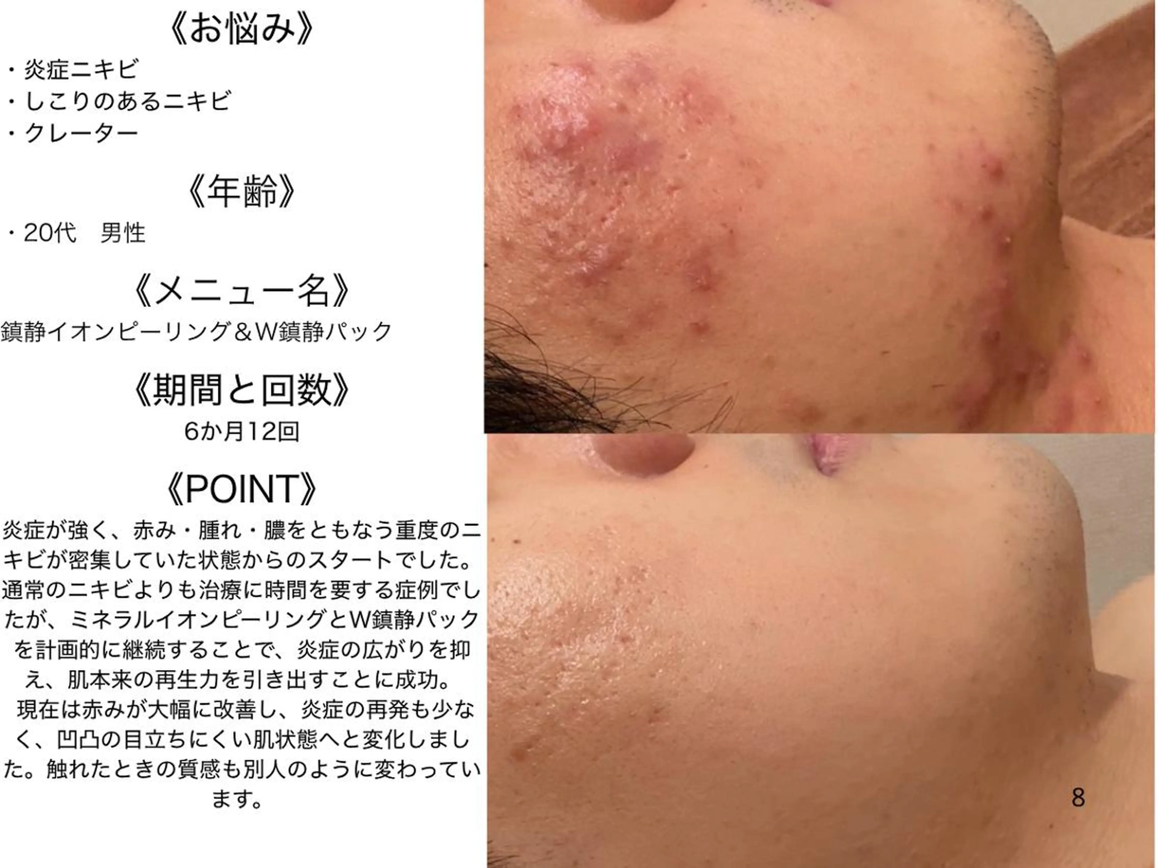 エステ リラク 3か月で肌革命👼 ニキビ専門店💫のエステ・リラクイメージ