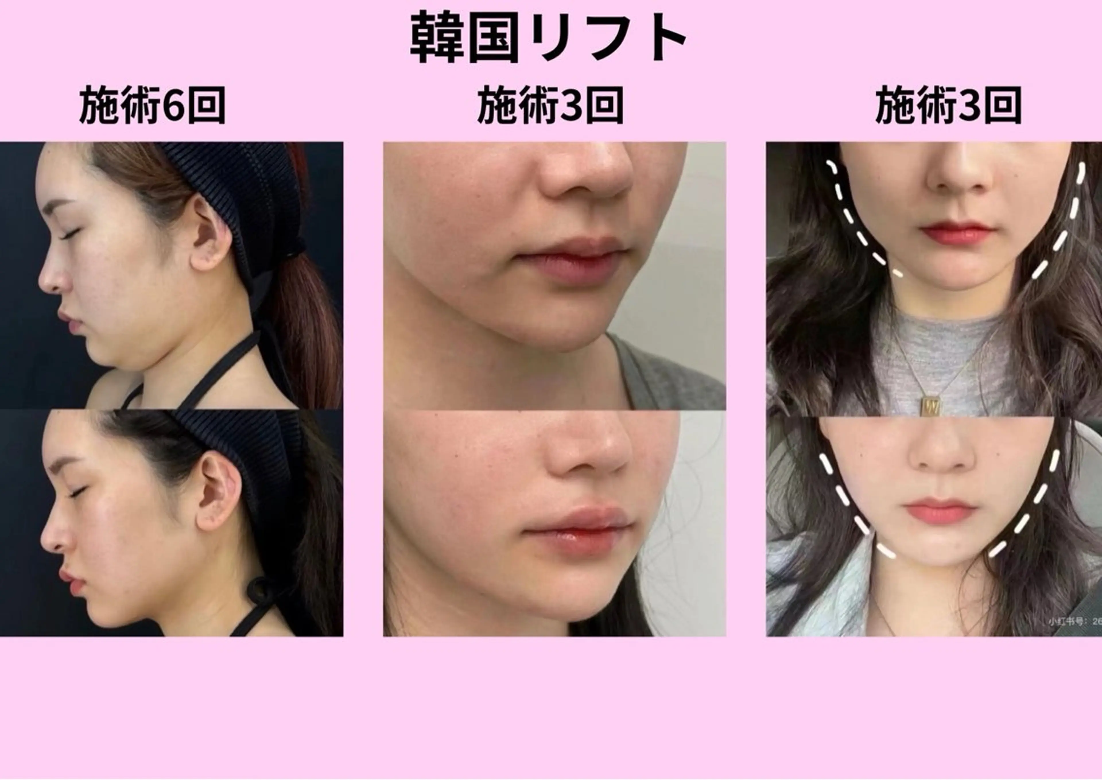 ネイル エステ aliaハーブ水光店 エステティシャン募集のエステ・リラクイメージ